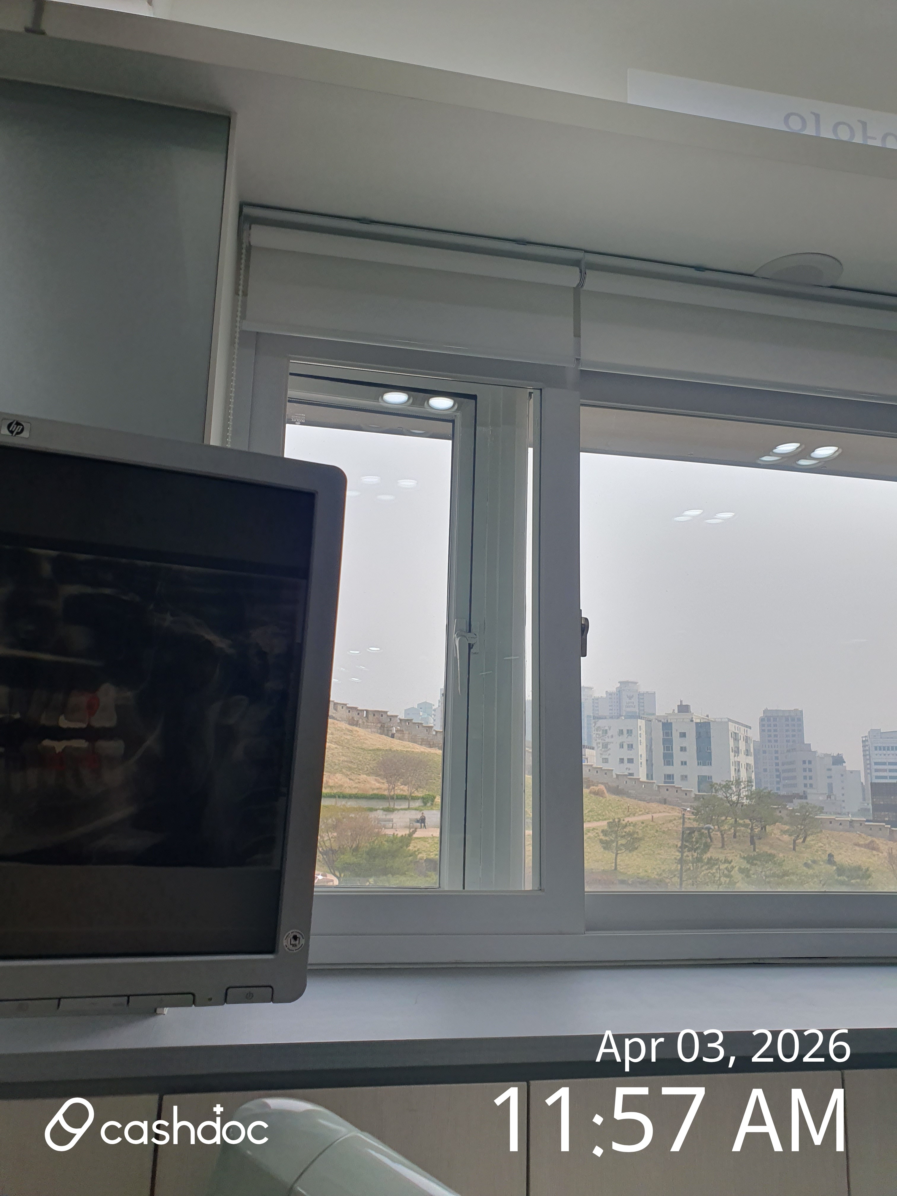 종로구 입안에행복치과의원, 잇몸치료 후기: 친절하고 과잉진료 없어요