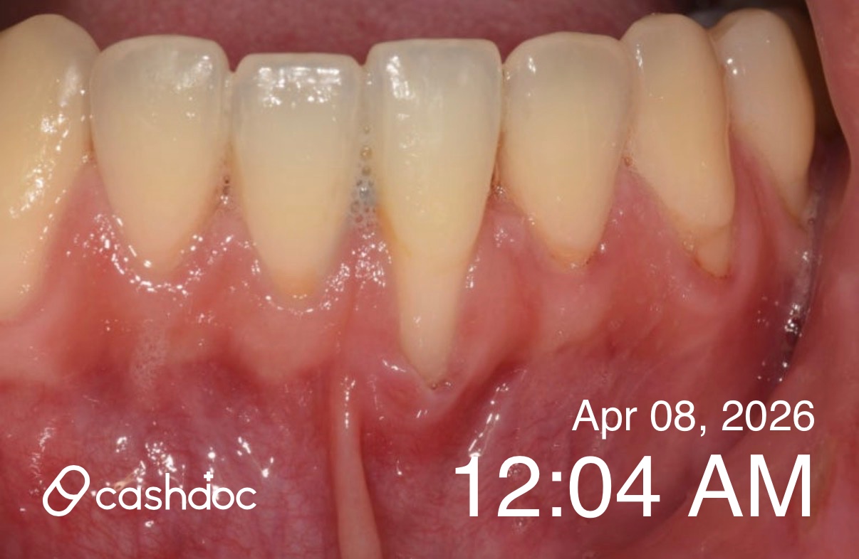 파주시 와이즈덴치과의원에서 수면마취로 무서움 없이 치료 경험