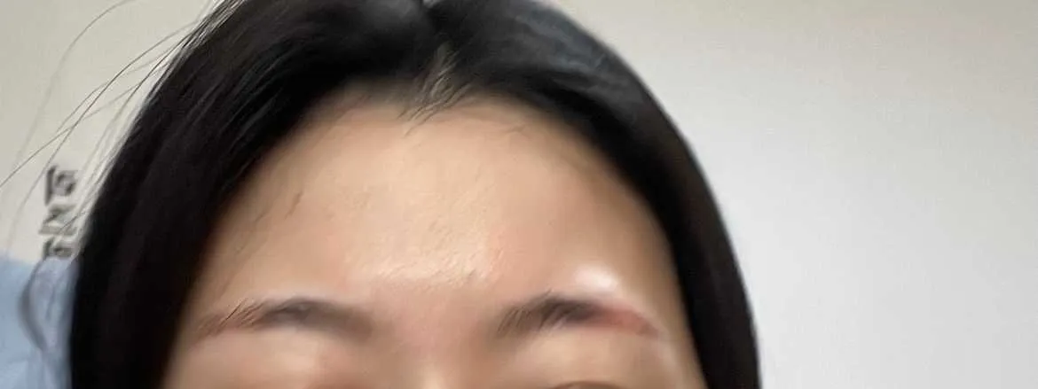 시술 전 — 안개눈썹 리터치 무제한 이벤트