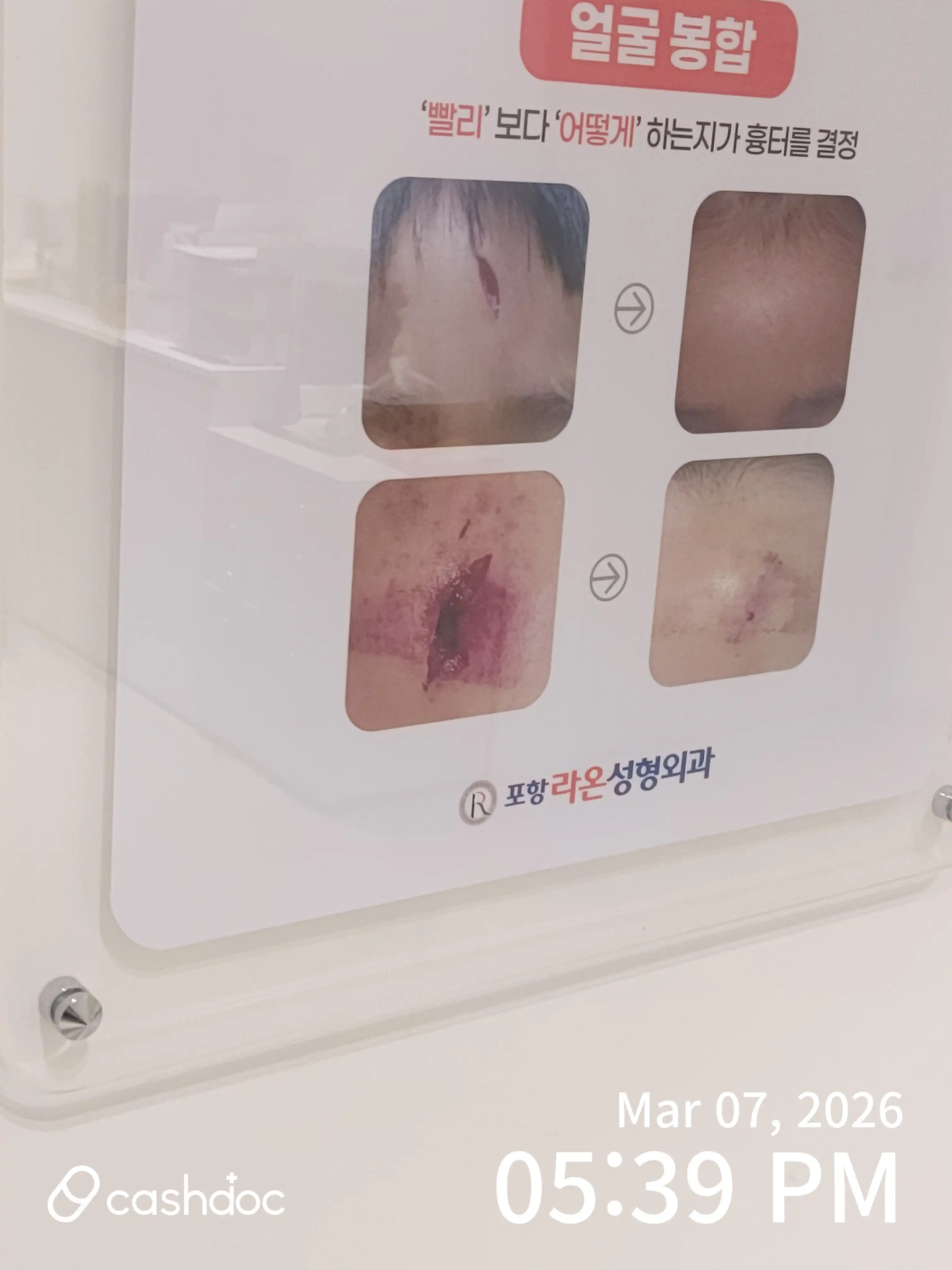 评价照片
