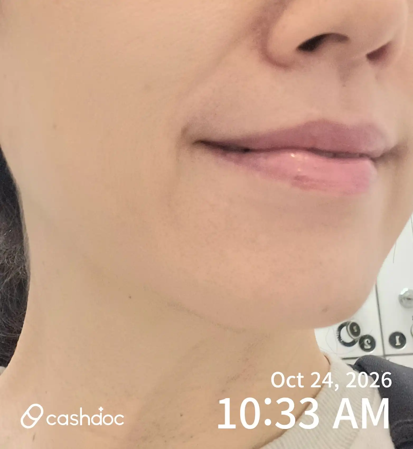 Maypure Clinic Suji Branch review photo