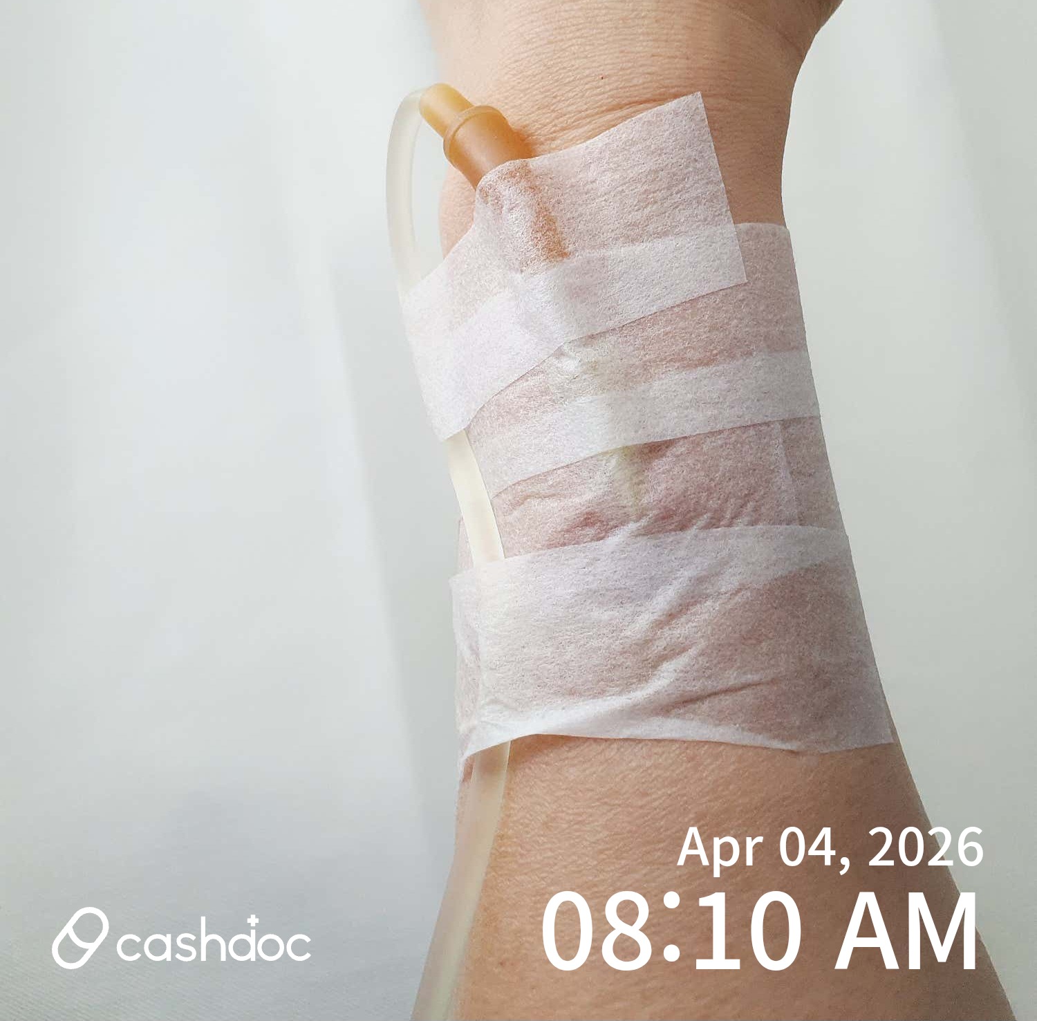 성남시 노블진내과의원, 증상 꼼꼼히 들어주고 주사로 회복!