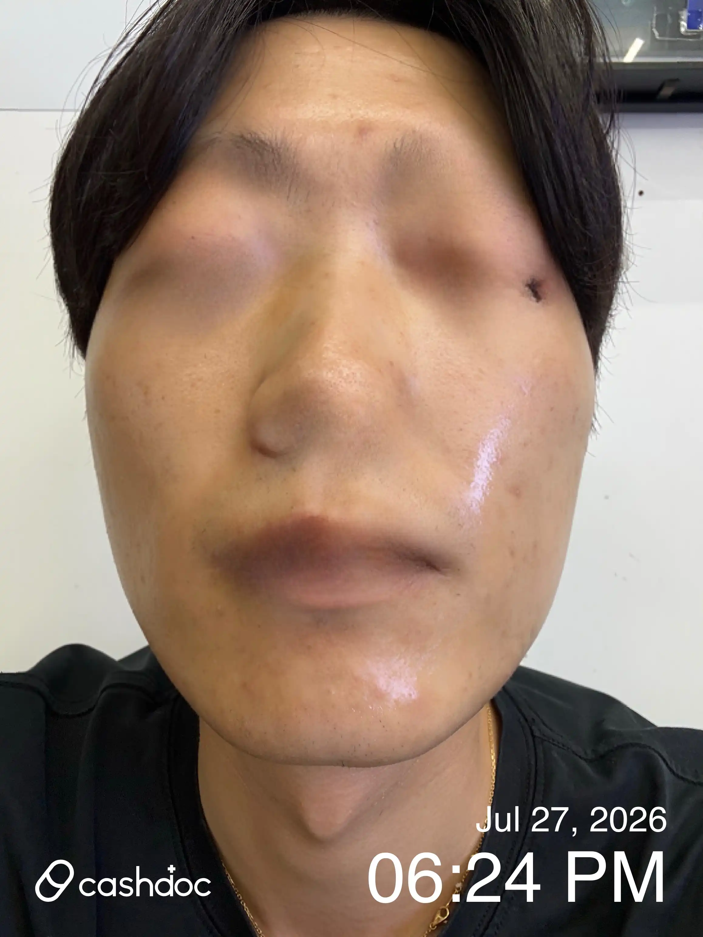 리뷰 사진