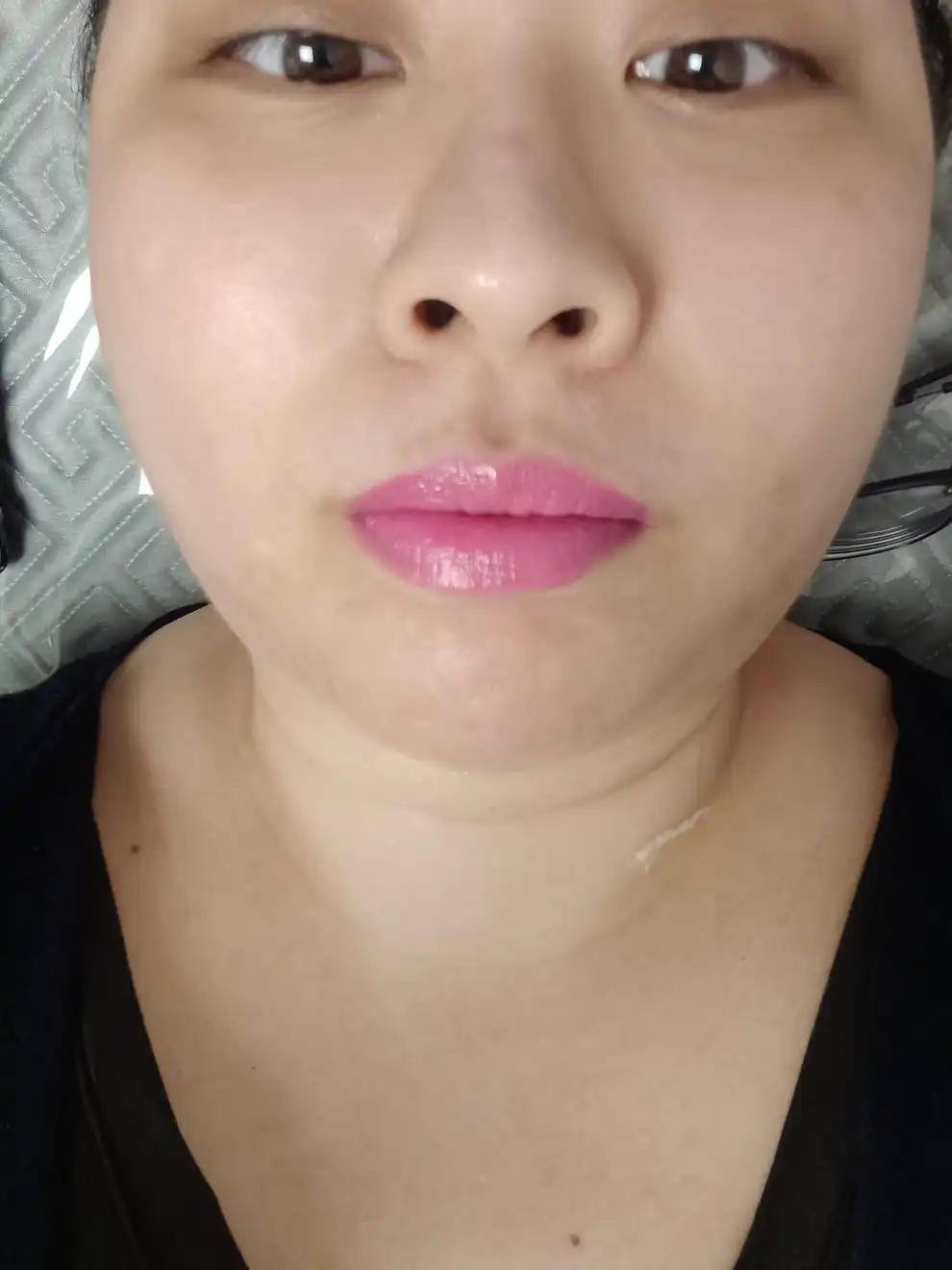 후
