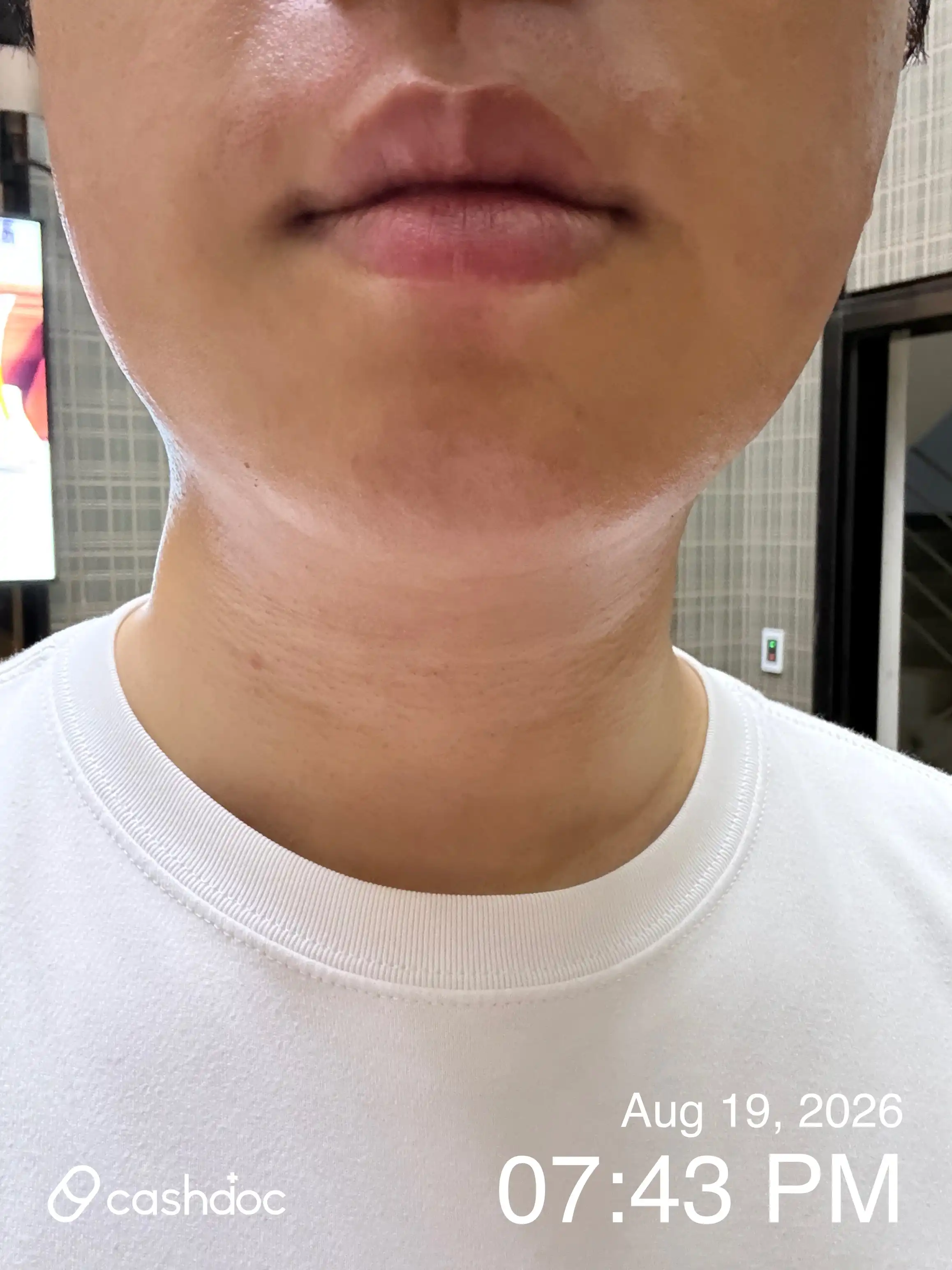 Review photo