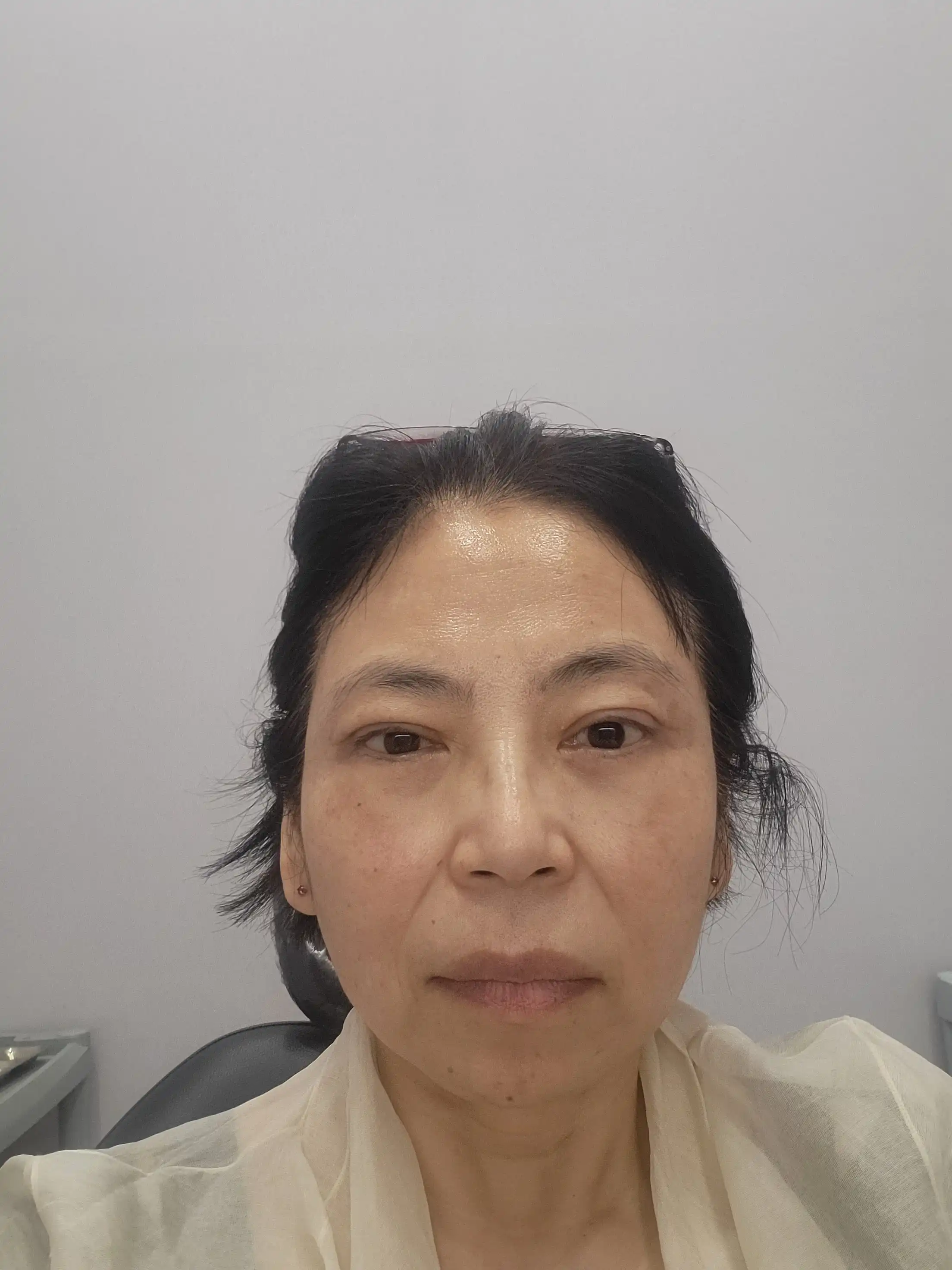 후