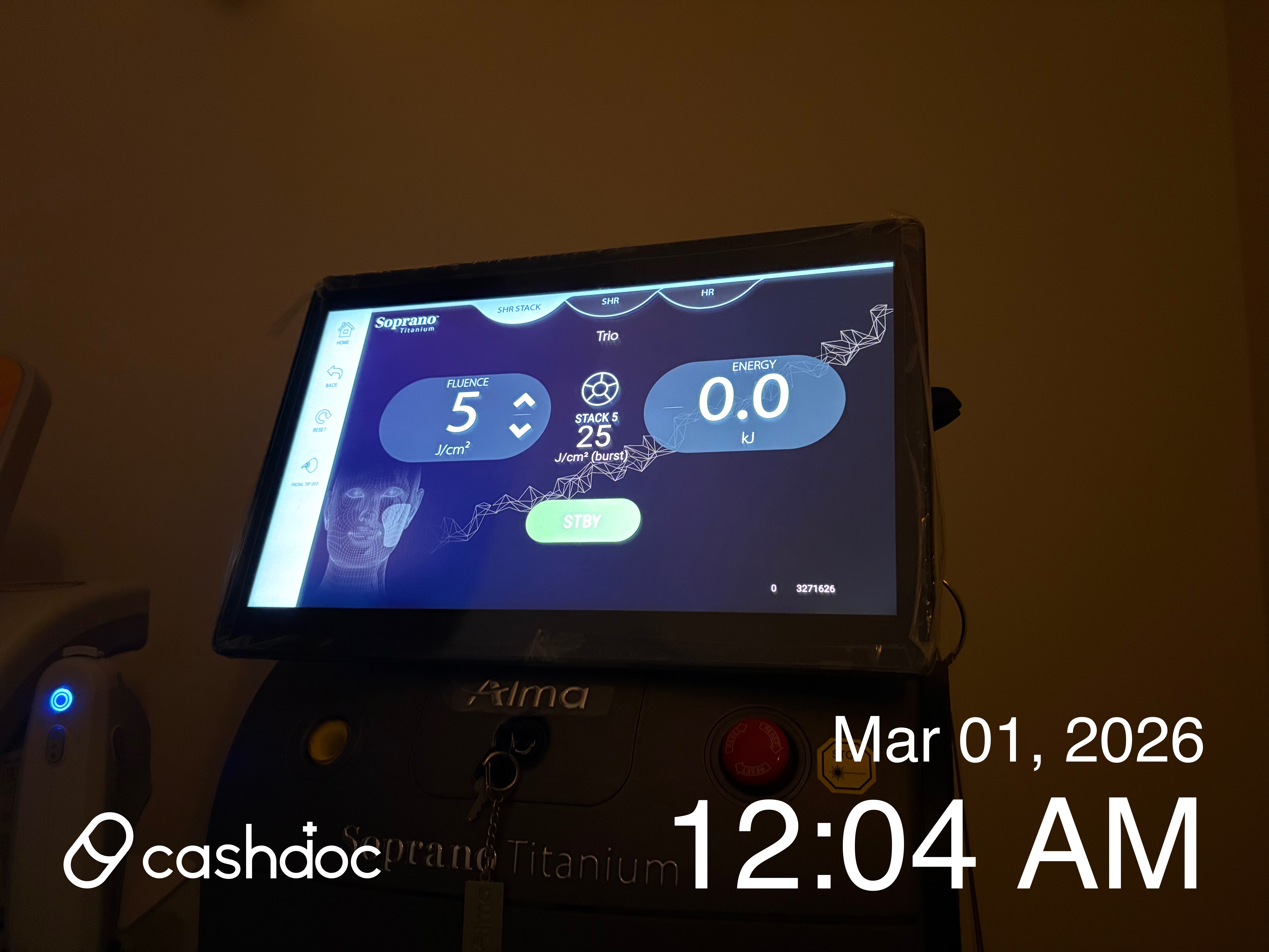 수성구 빌리브피부과, 울쎄라 시술 후기: 친절하고 대체로 안아팠어요