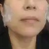 前