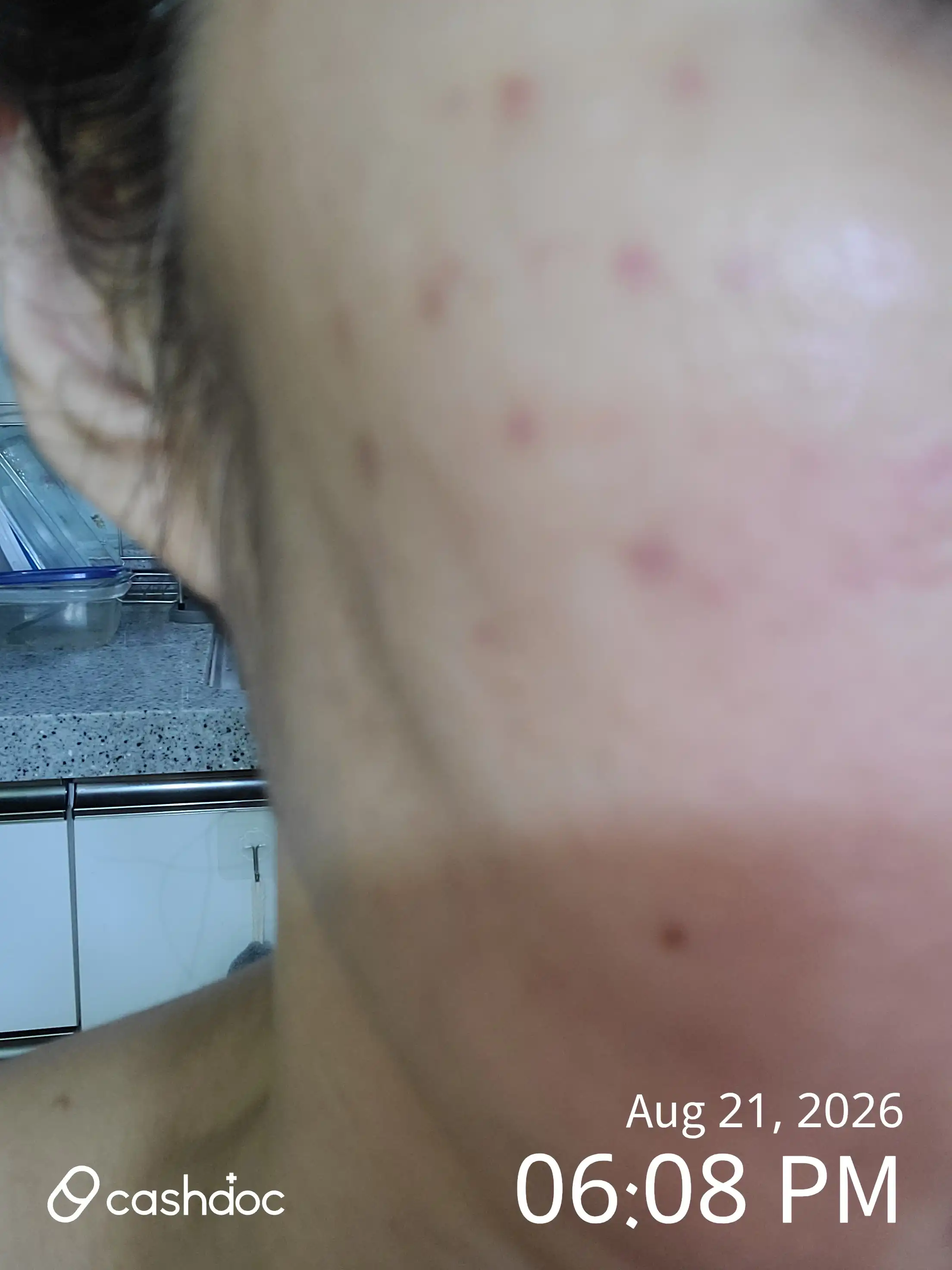 Review photo