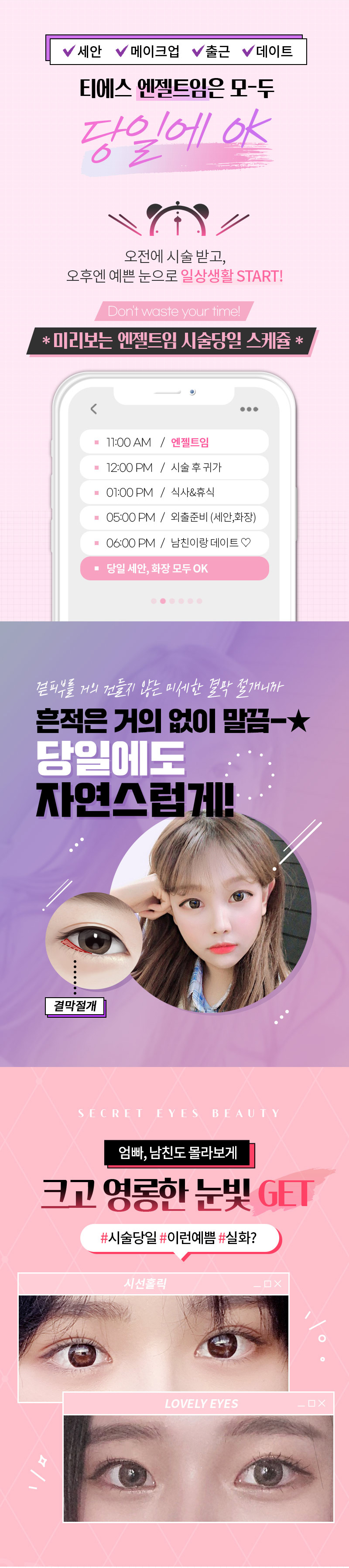 티에스성형외과 티에스 엔젤트임 이벤트, 시술 상세 이미지