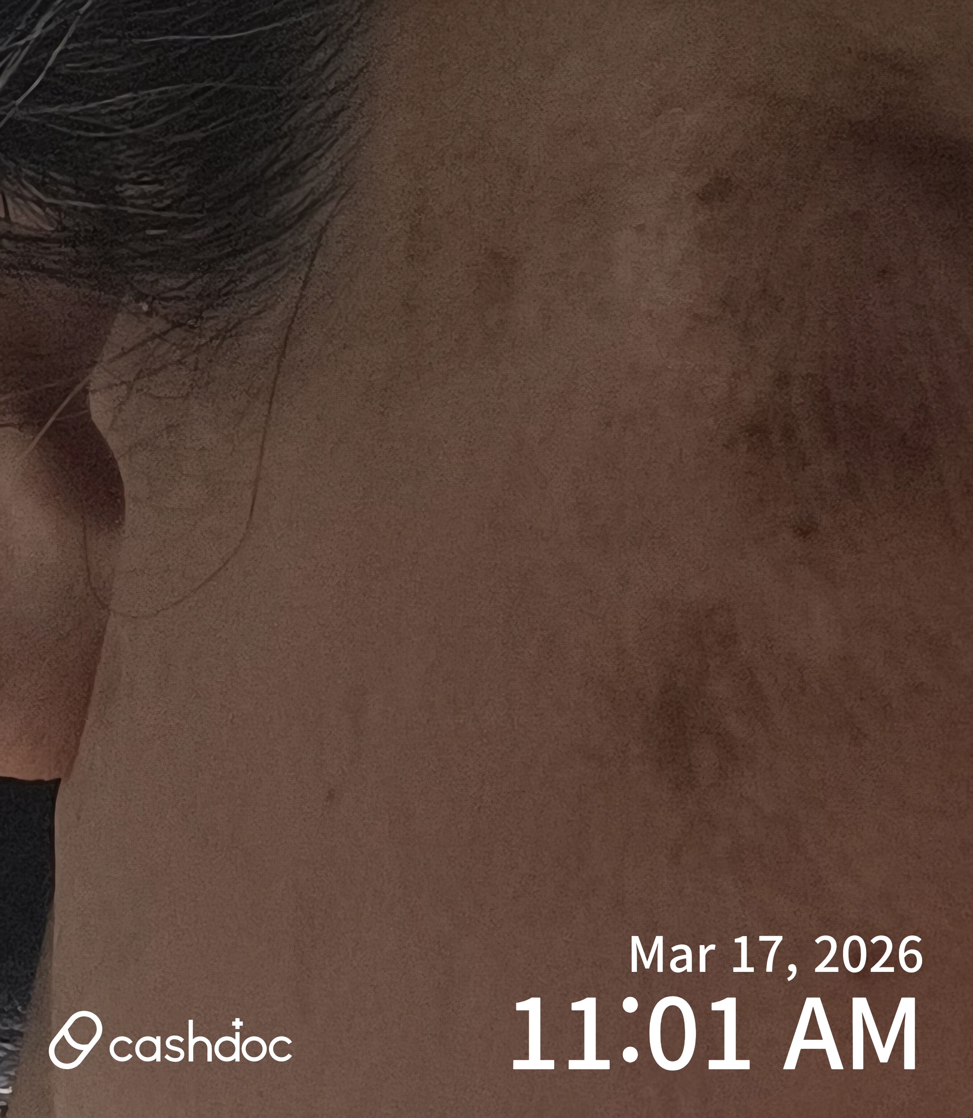 안양시 김영도피부과의원에서 피고의 처방이 계속되는 불편함