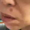 후