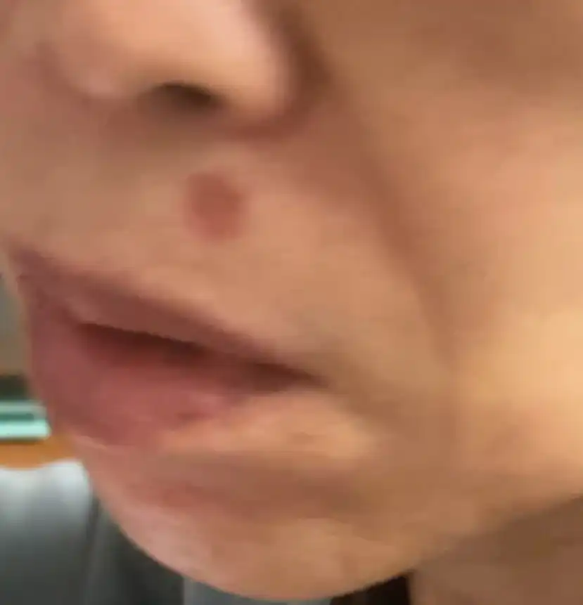 후