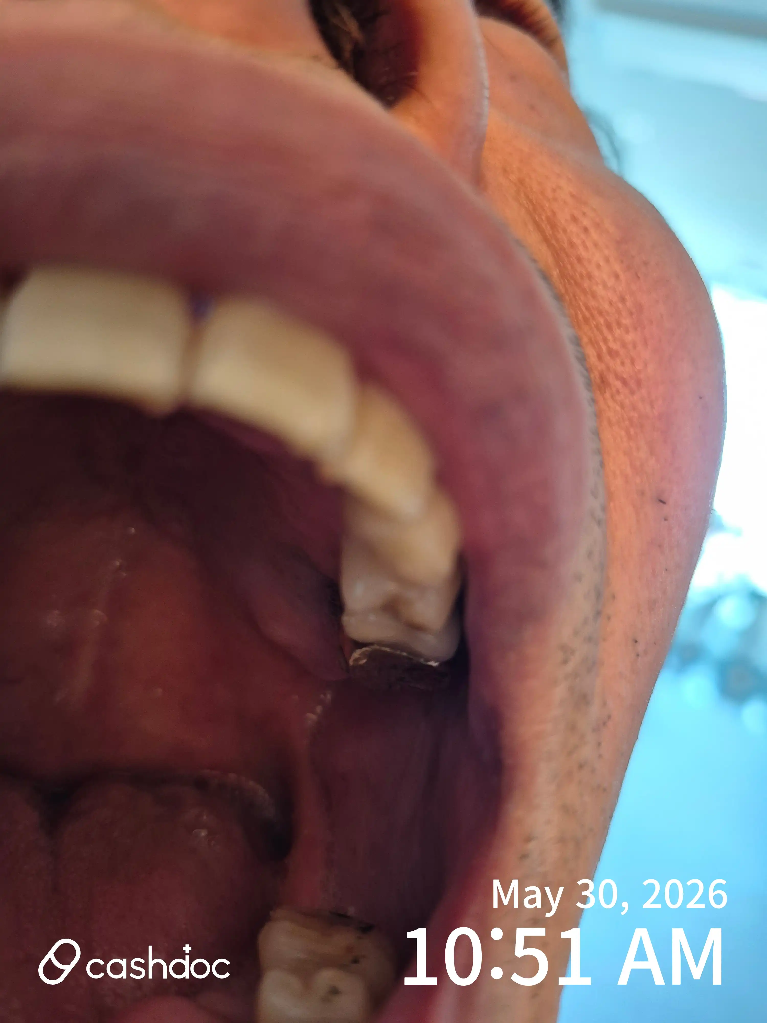 Review photo