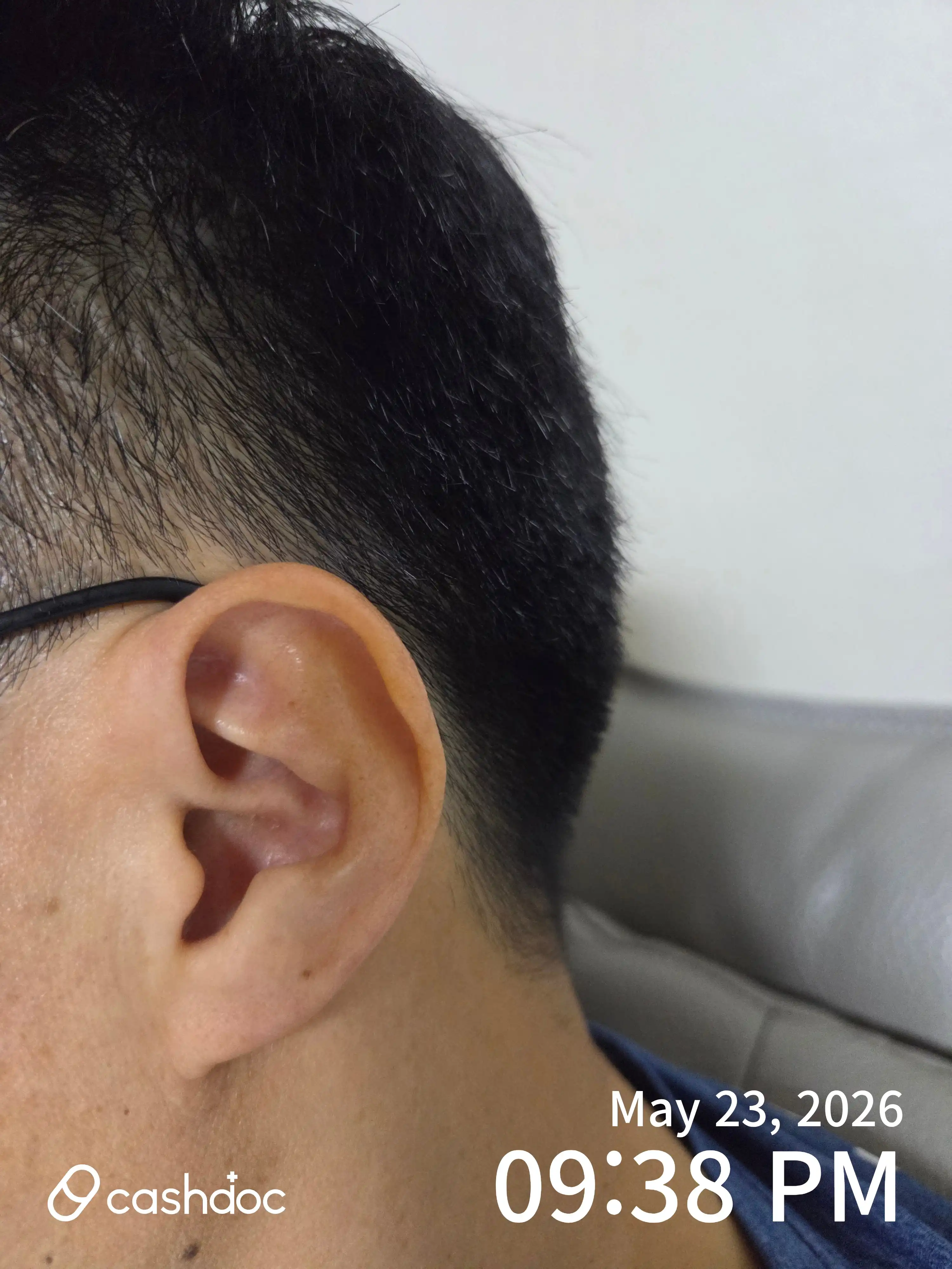 Review photo
