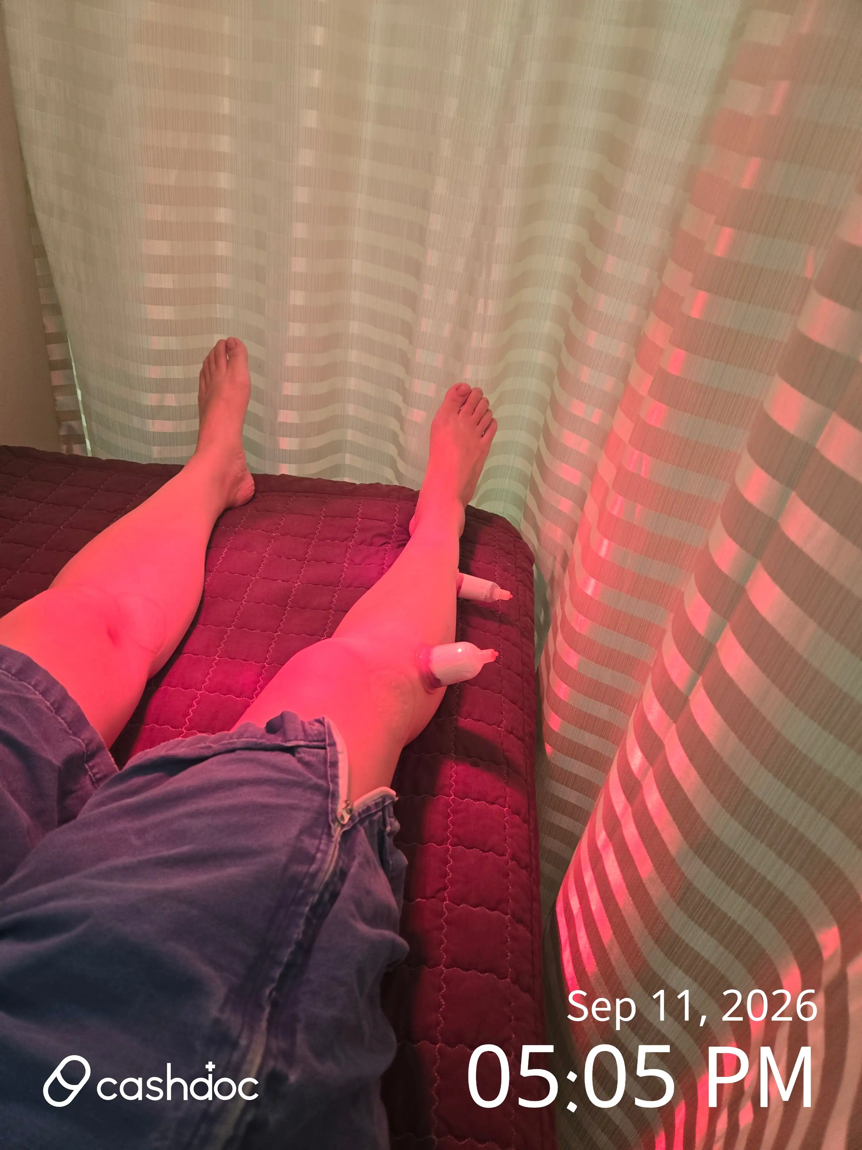 评价照片