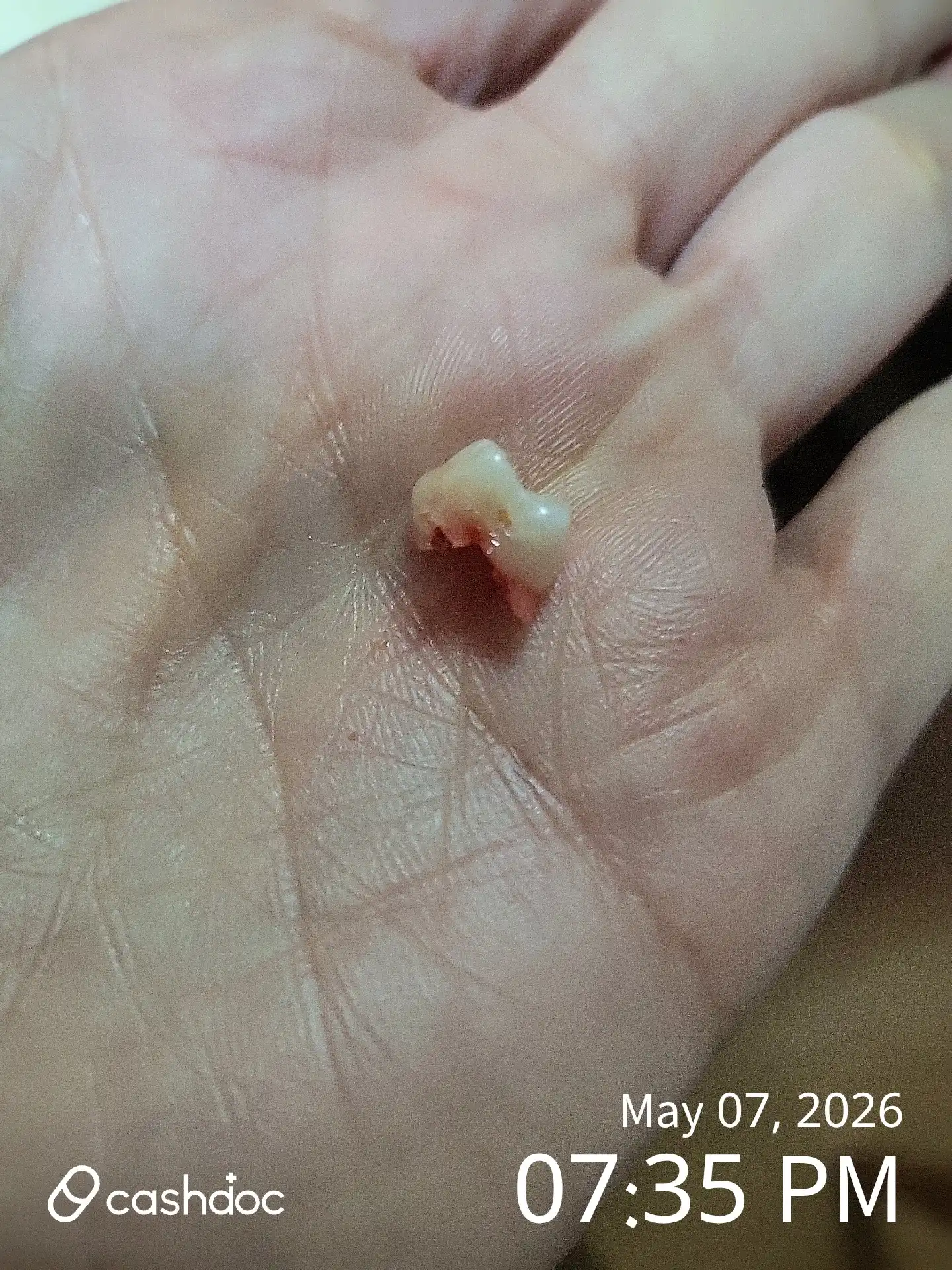 Review photo