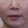 前