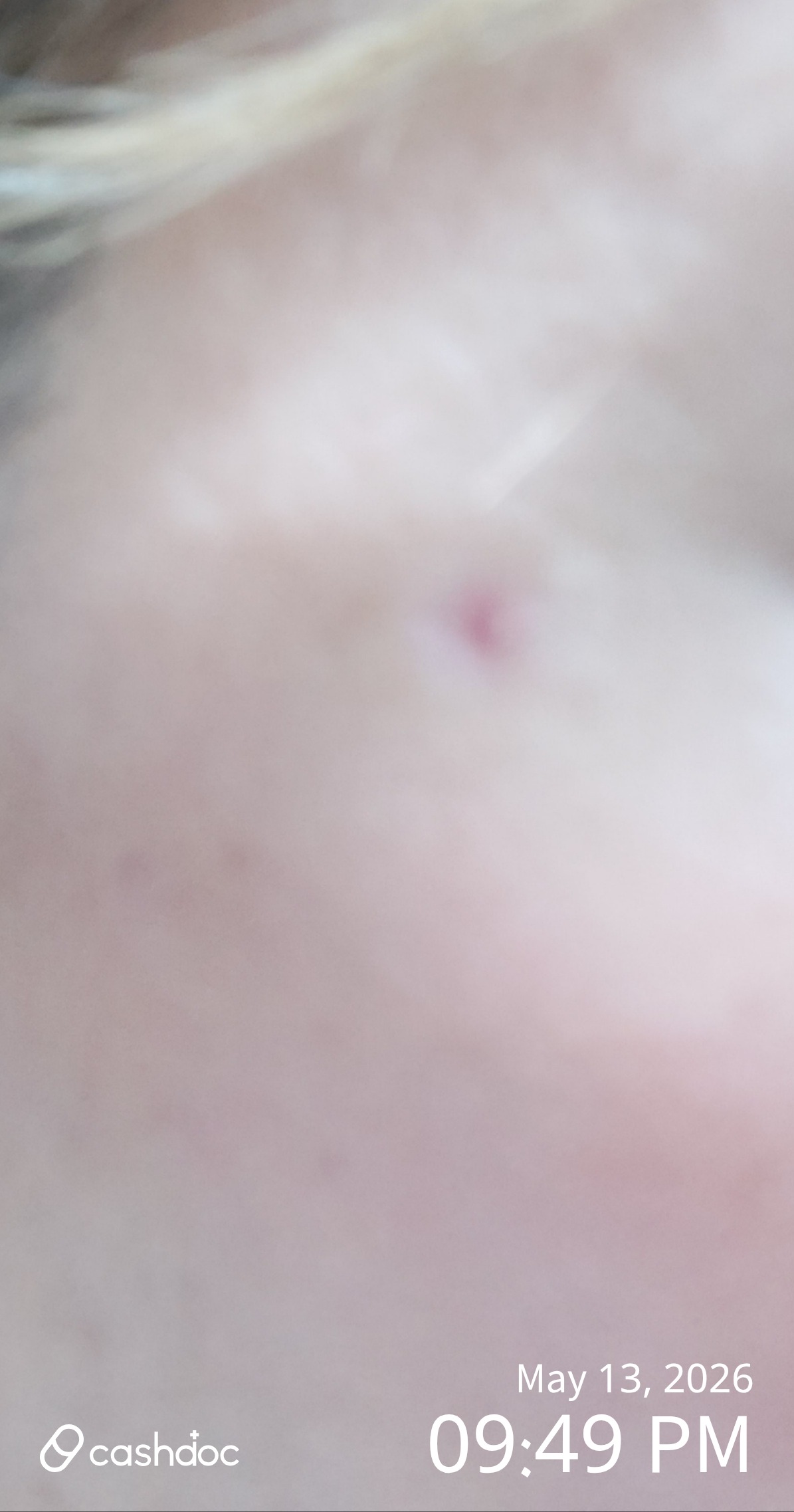 Eom Dermatology Clinic in Nam-gu, a ridiculous experience compared to the treatment price