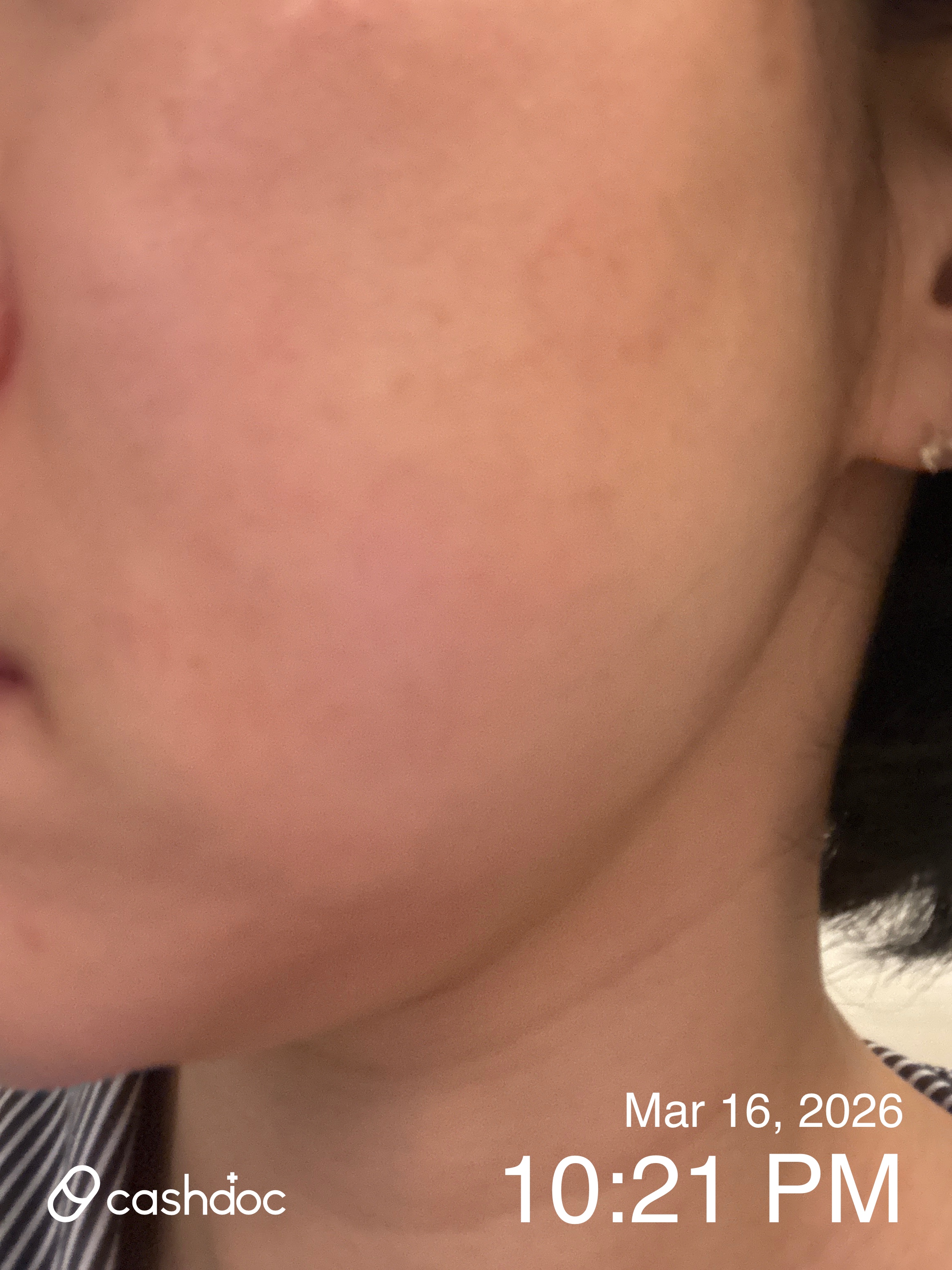 강서구 차앤유의원, 원장님이 직접 진료와 턱보톡스 시술해요