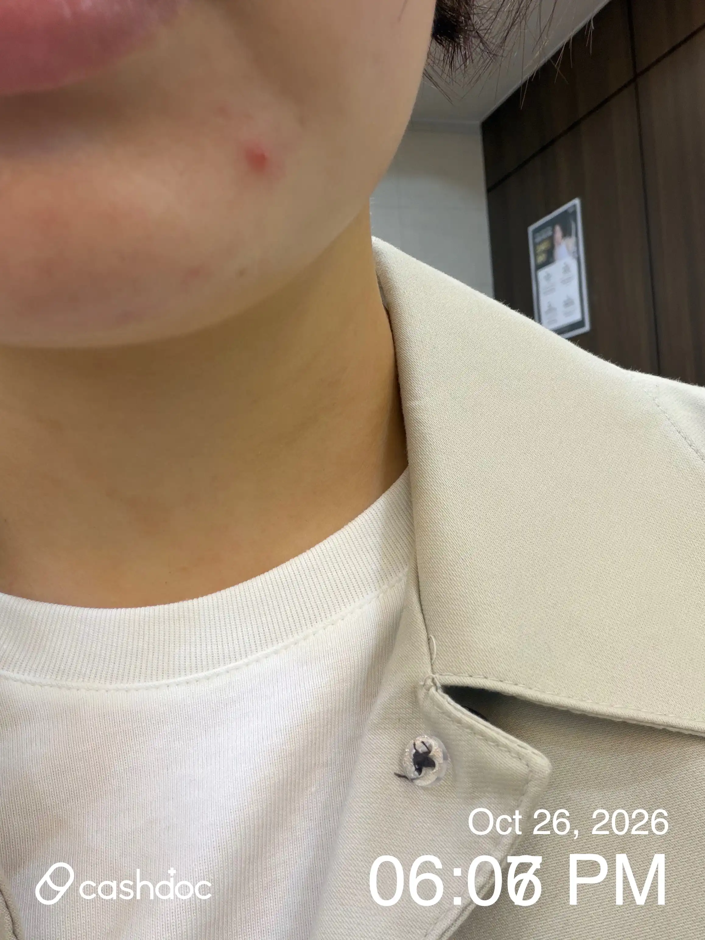 美璞诊所 花井分院 评价照片