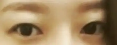 전