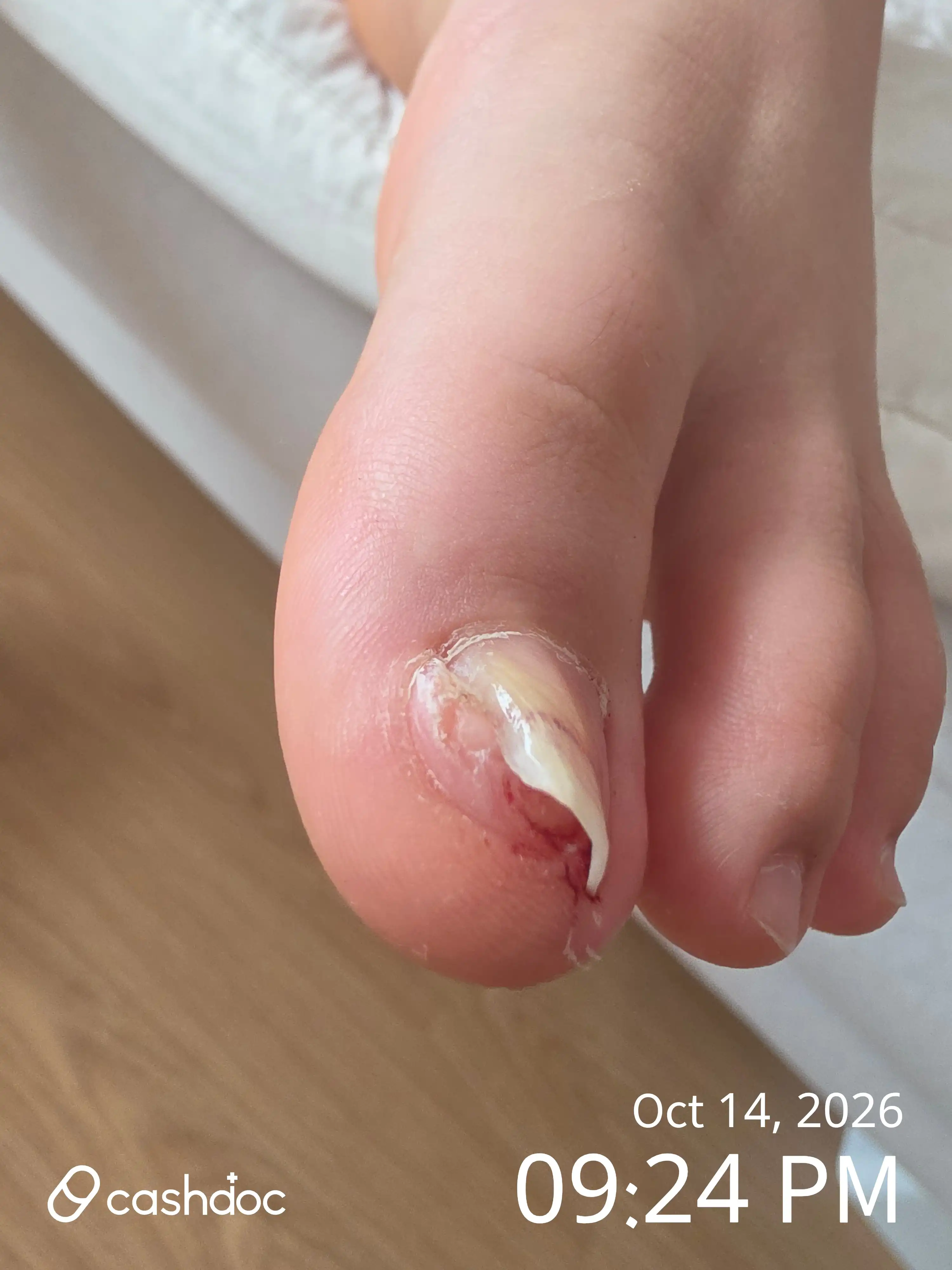 마이클래식피부과의원 후기 사진
