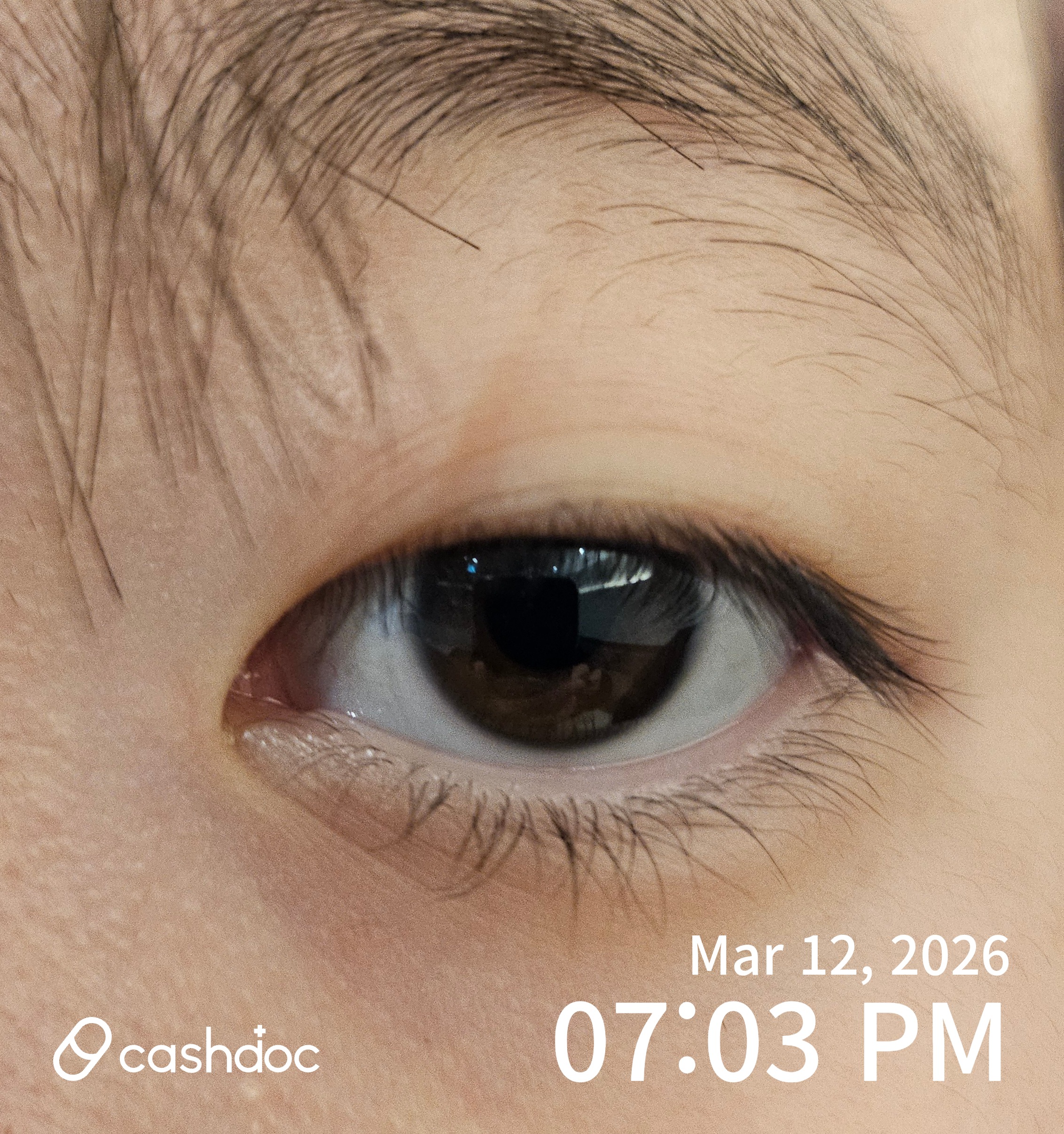 광주시 태전김안과의원, 알레르기성 결막염 친절한 진료 후기