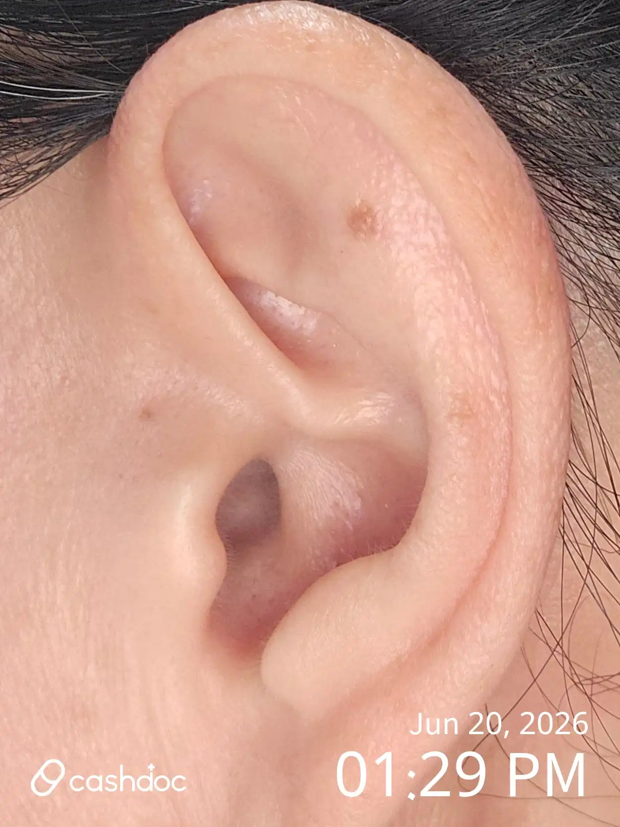 Review photo