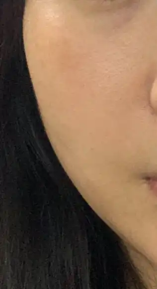 전