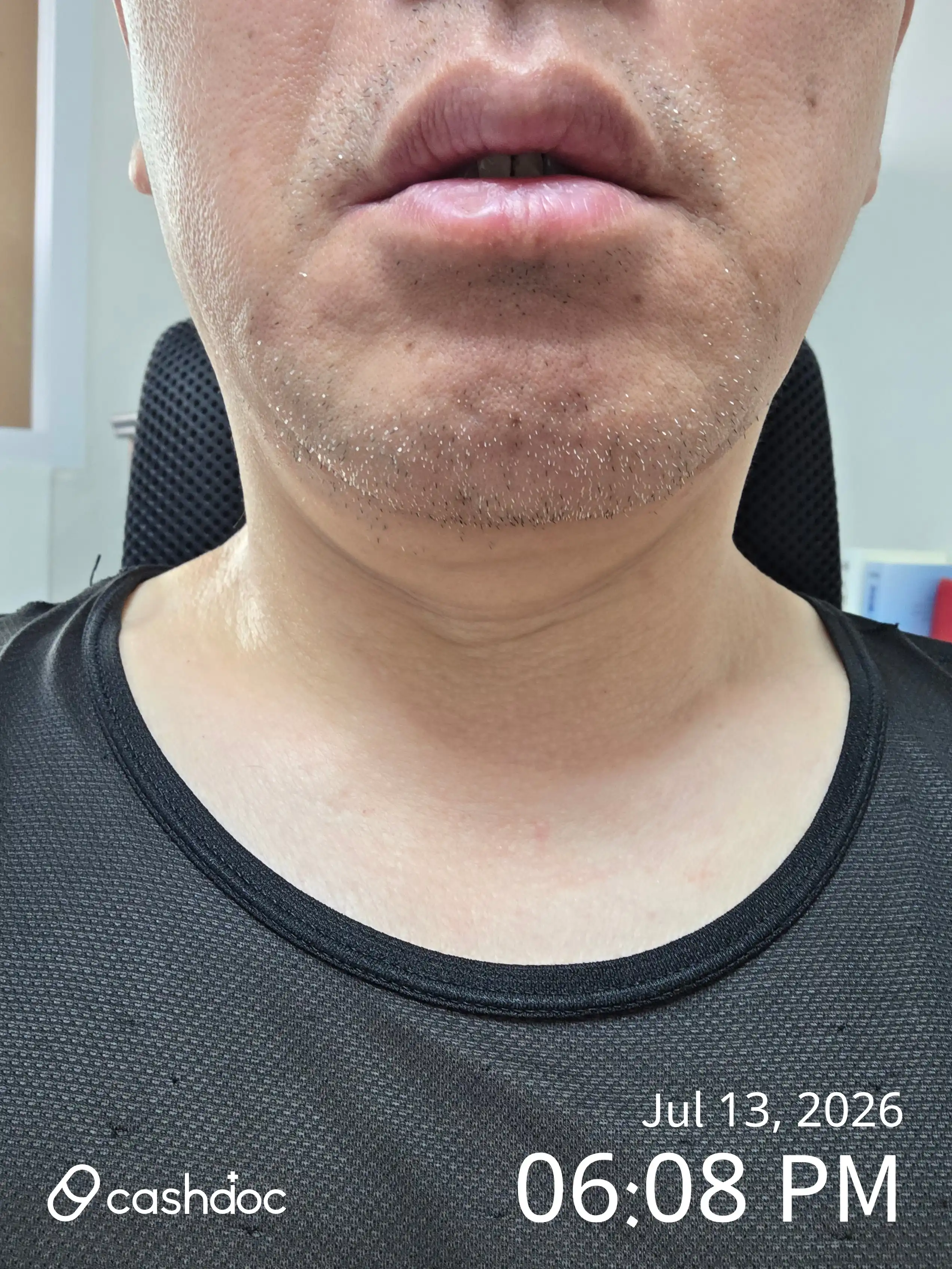 评价照片