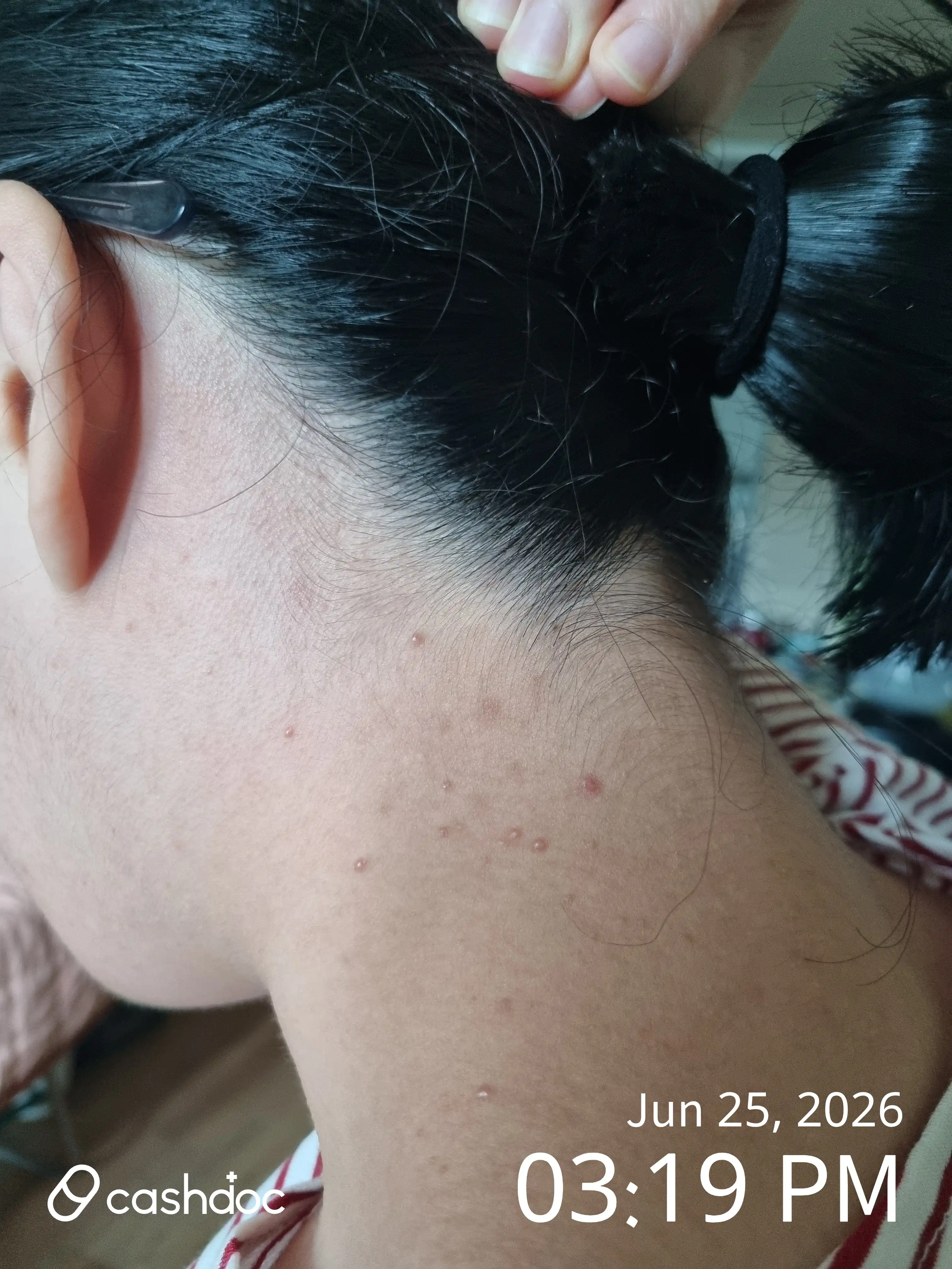 Review photo