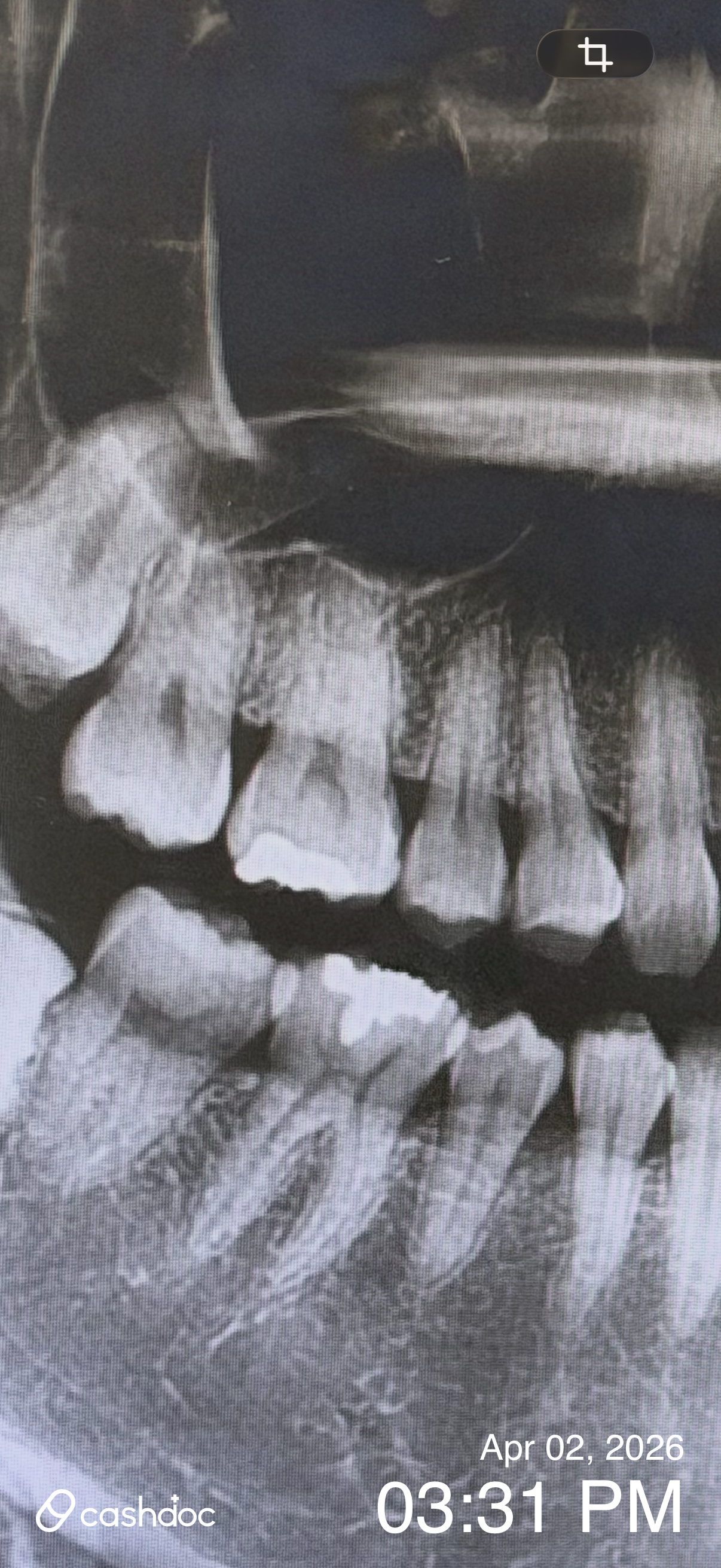 남양주시 서울OK치과의원에서 교정 상담, 매우 만족했어요!
