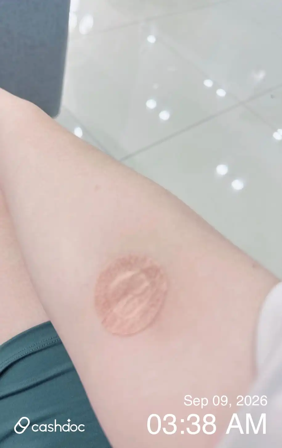 评价照片