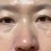 後