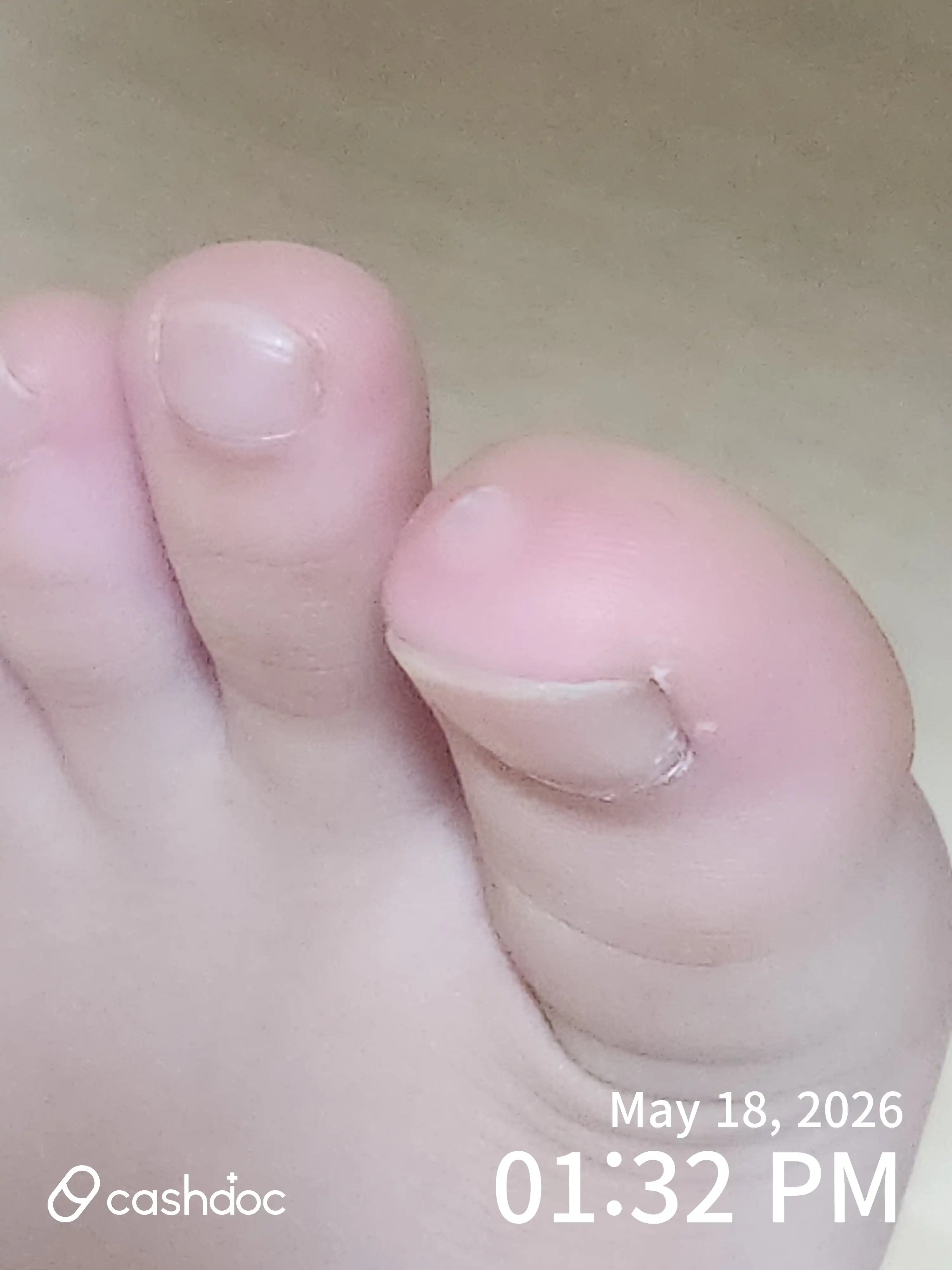 评价照片