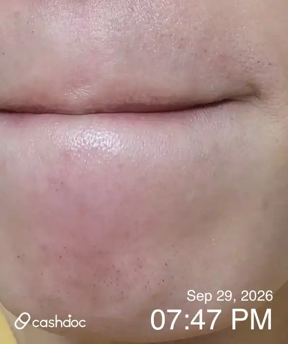 评价照片