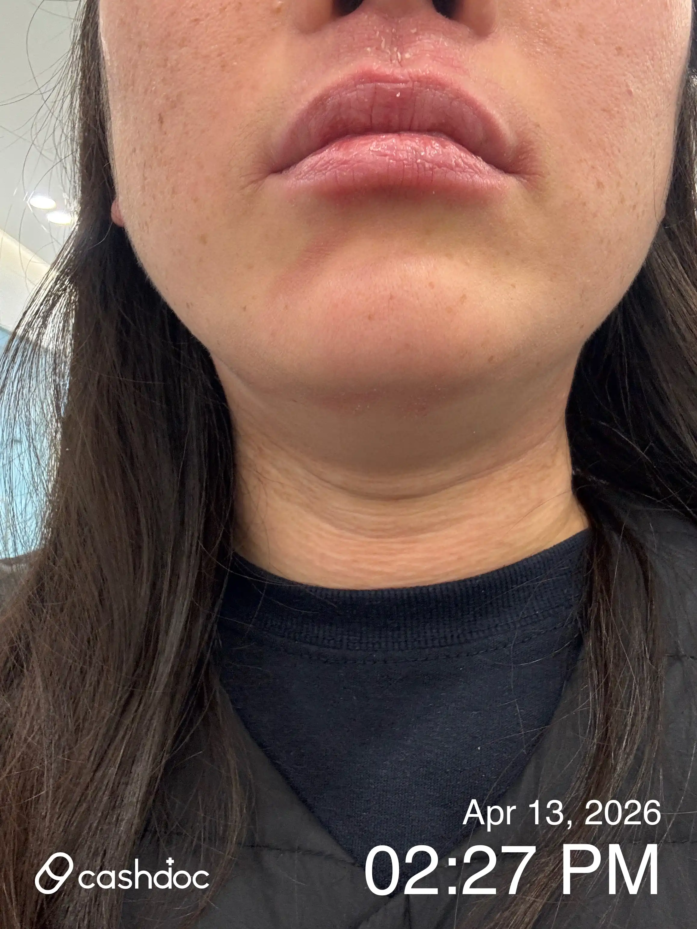 Review photo