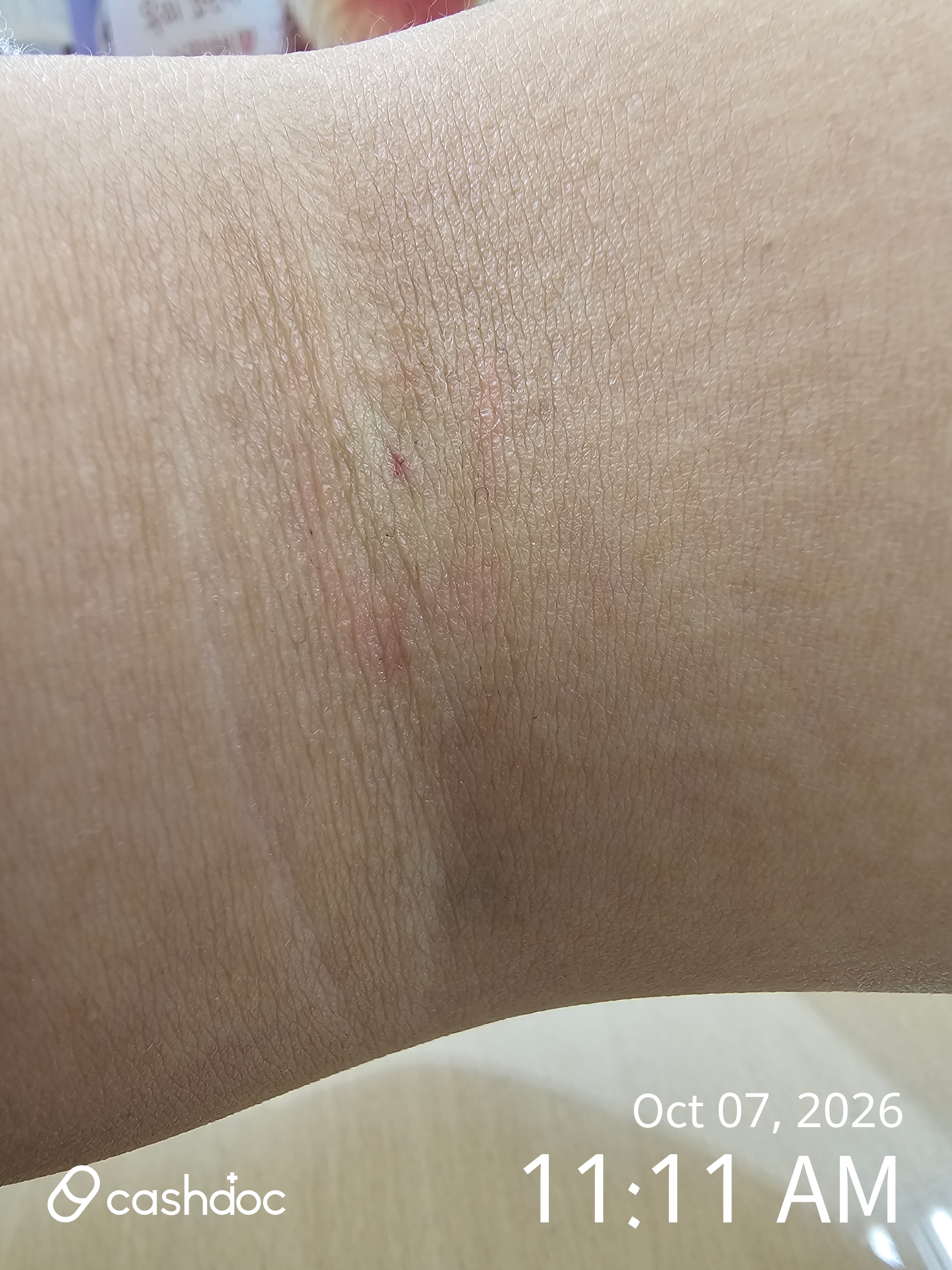 Review photo