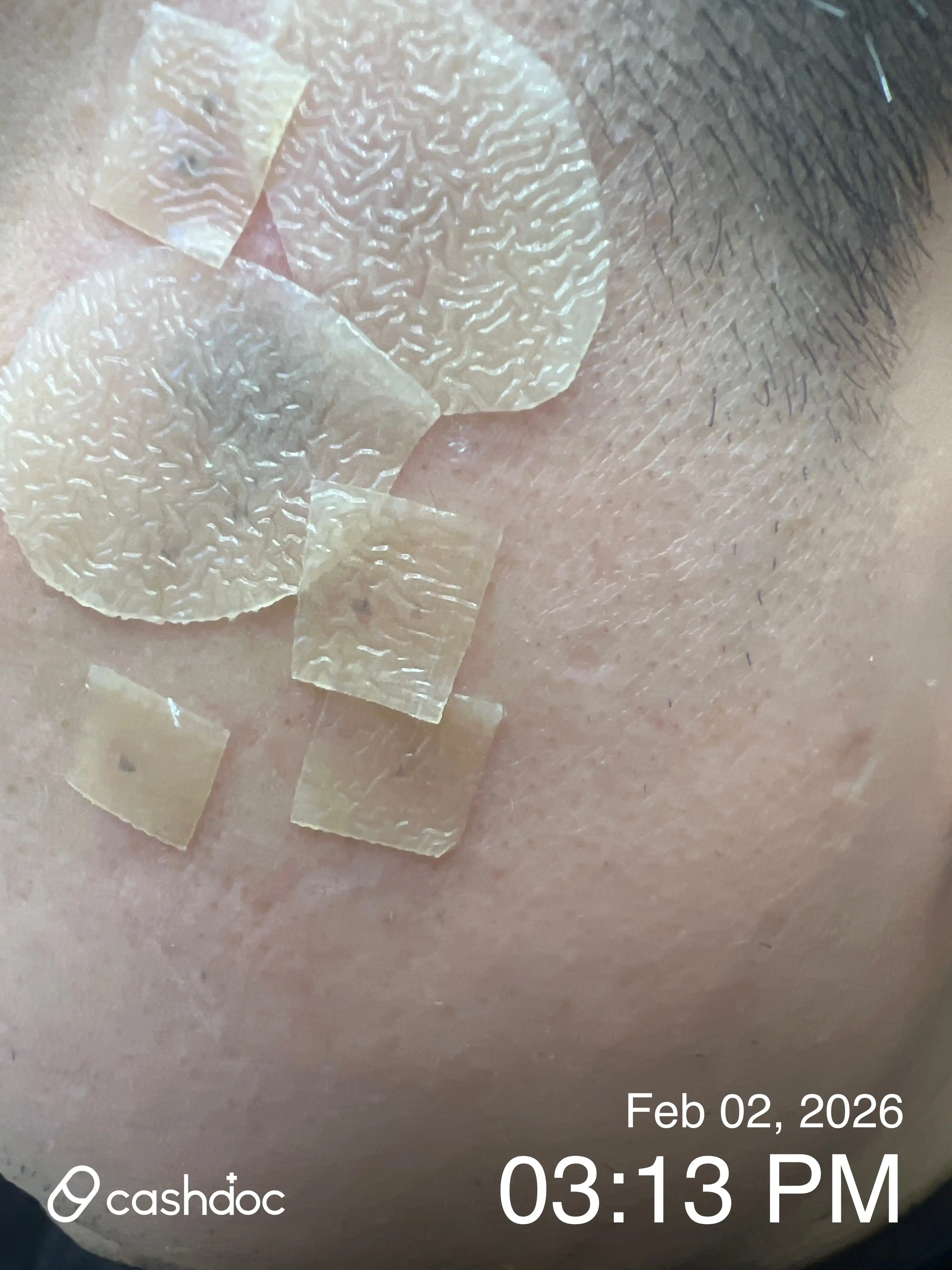 评价照片