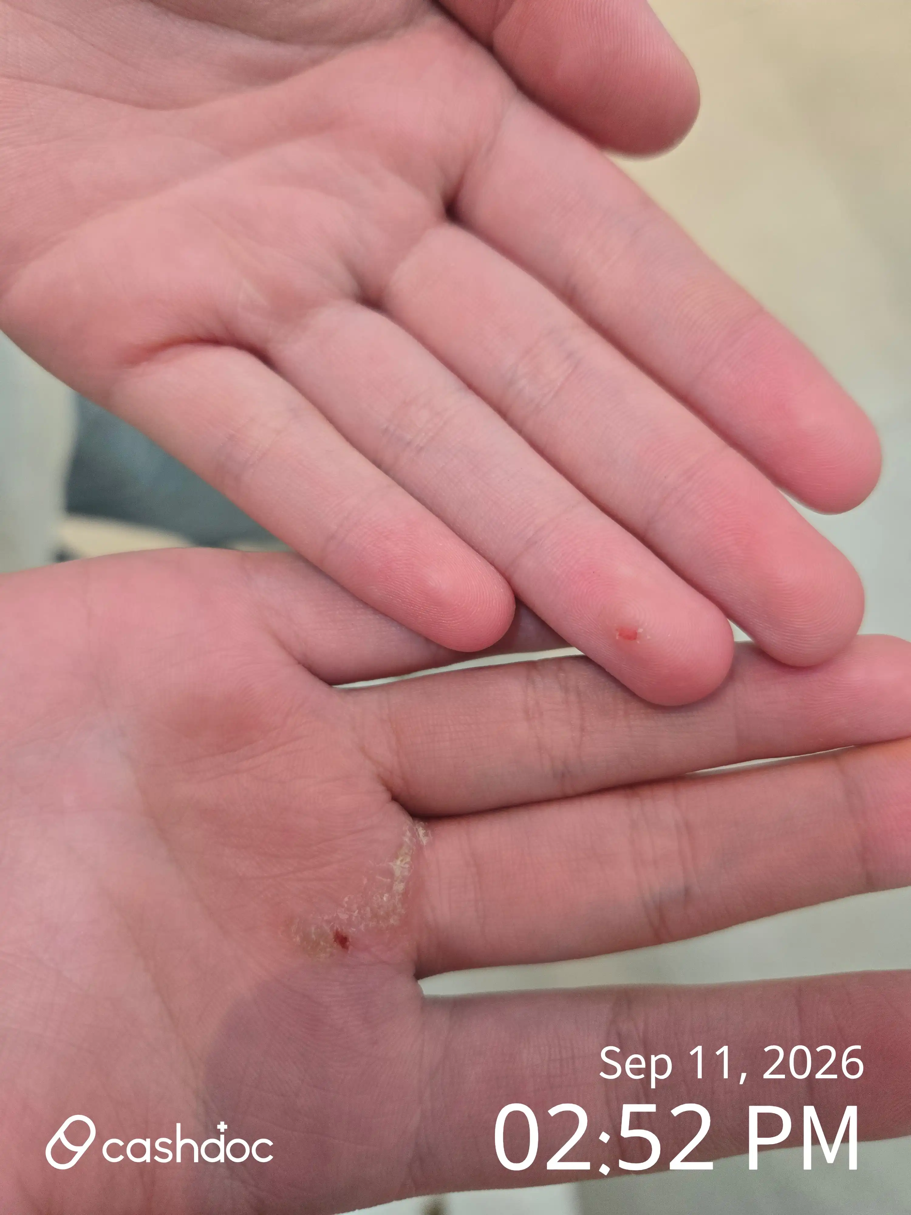 评价照片