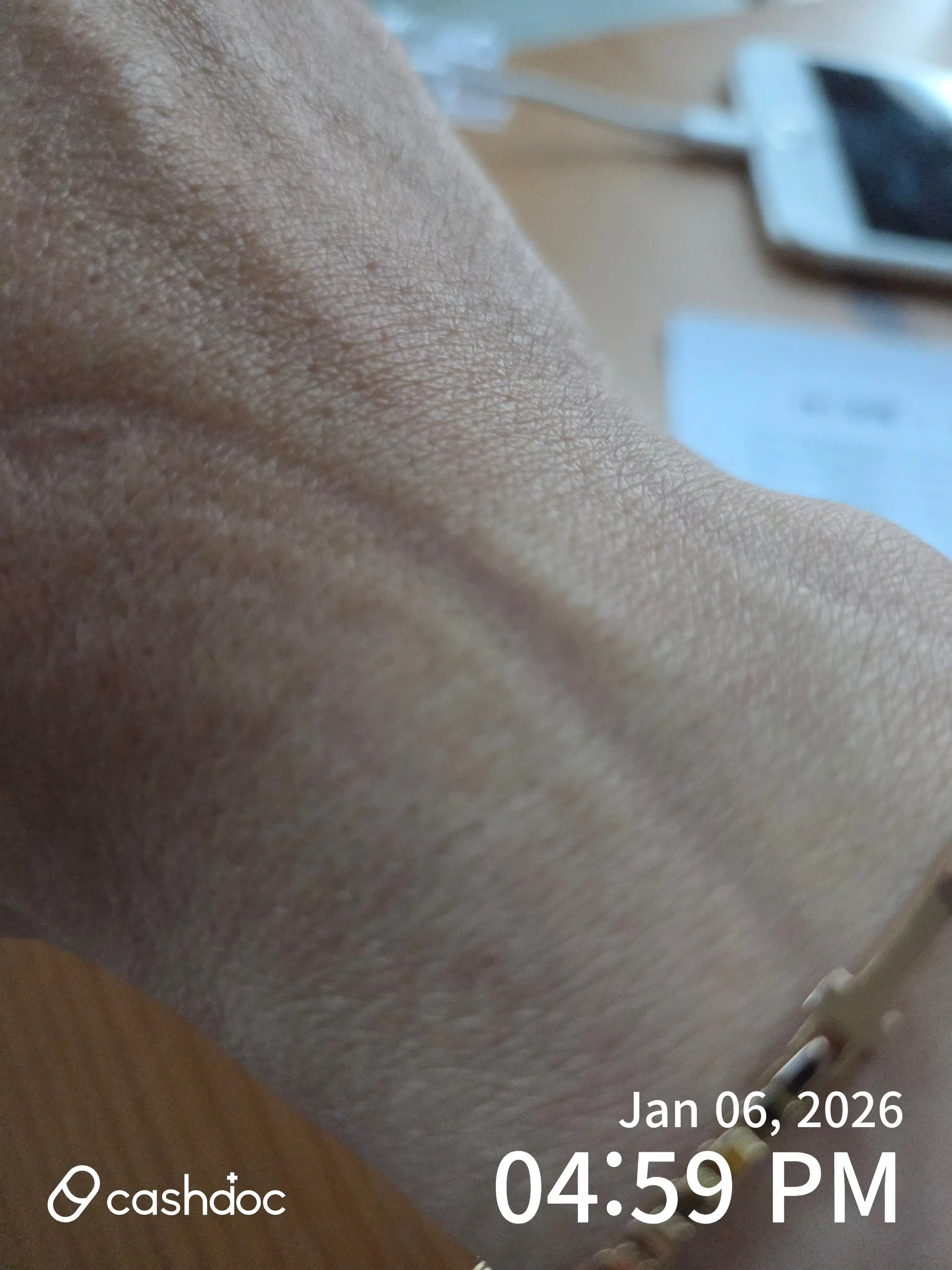 Review photo