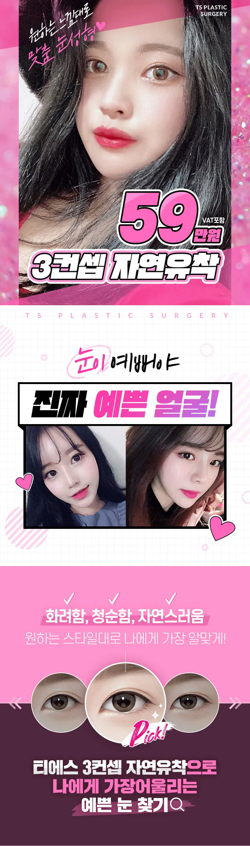 티에스성형외과 티에스 첫눈 3컨셉 자연유착 이벤트, 시술 상세 이미지