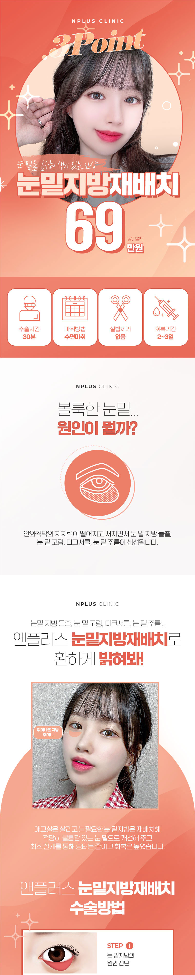 앤플러스의원 앤플러스 눈밑지방재배치 이벤트, 시술 상세 이미지