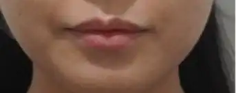 전