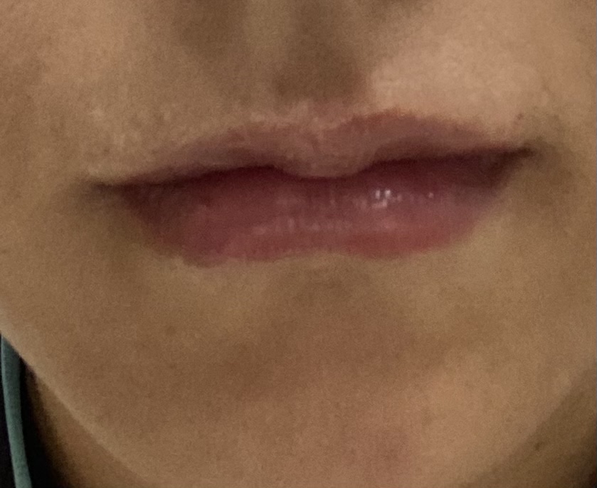 后
