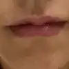 后
