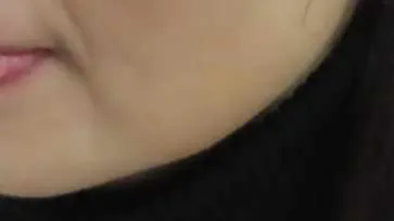 시술 전 — 미케이 민트실 동안 리프팅_팔자,눈가