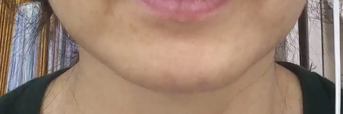 评价照片