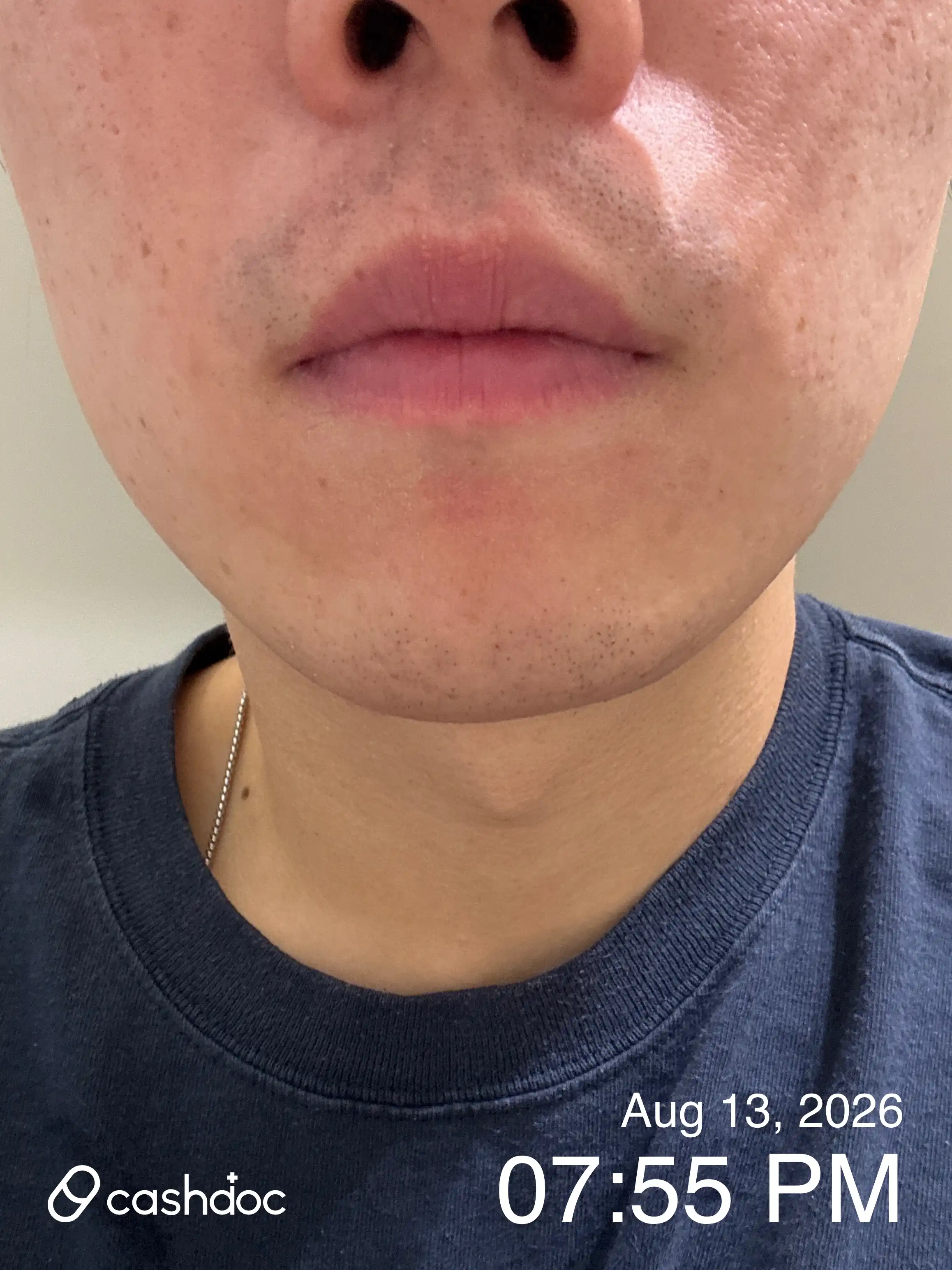 Review photo